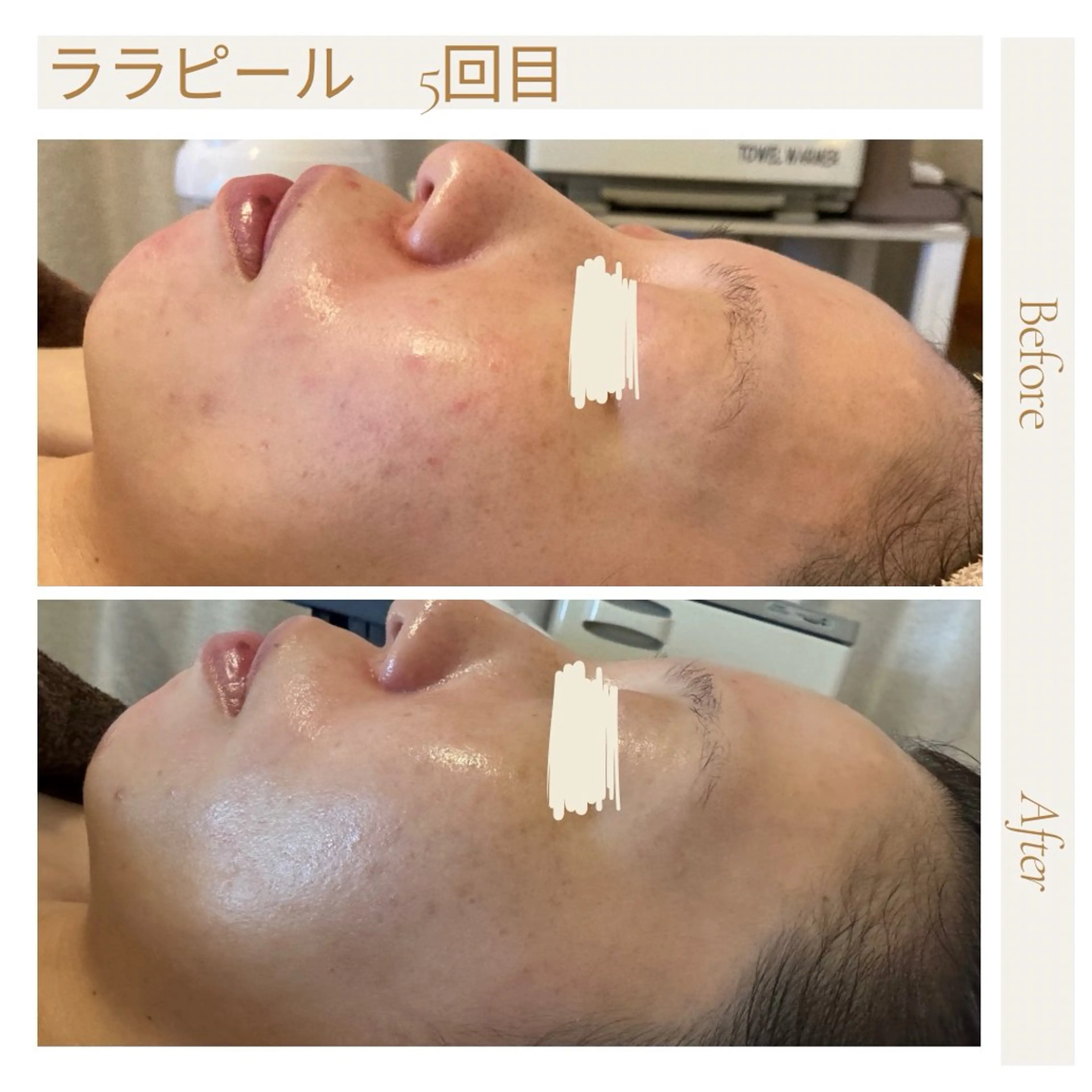 美肌脱毛と癒しのﾌﾟﾗｲﾍﾞｰﾄｻﾛﾝ。gratia~ｸﾞﾚｲﾃｨｱ~所属・gratia ~ｸﾞﾚｲﾃｨｱ~のエステ・リラクイメージ