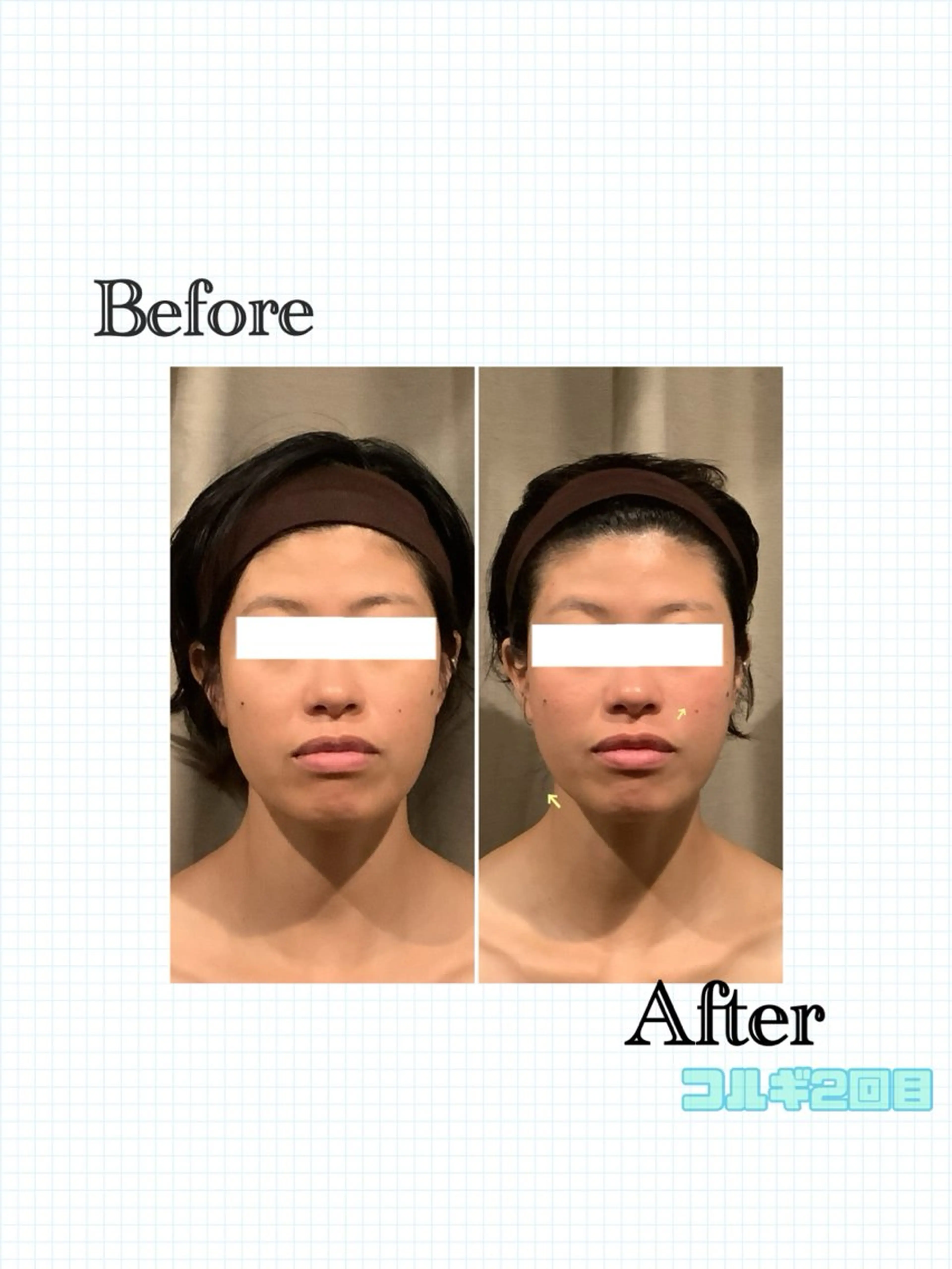 小顔整体美容を科学する【小顔FaceLabo.】横浜店所属・小顔FaceLabo 横浜店  篠原のエステ・リラクイメージ