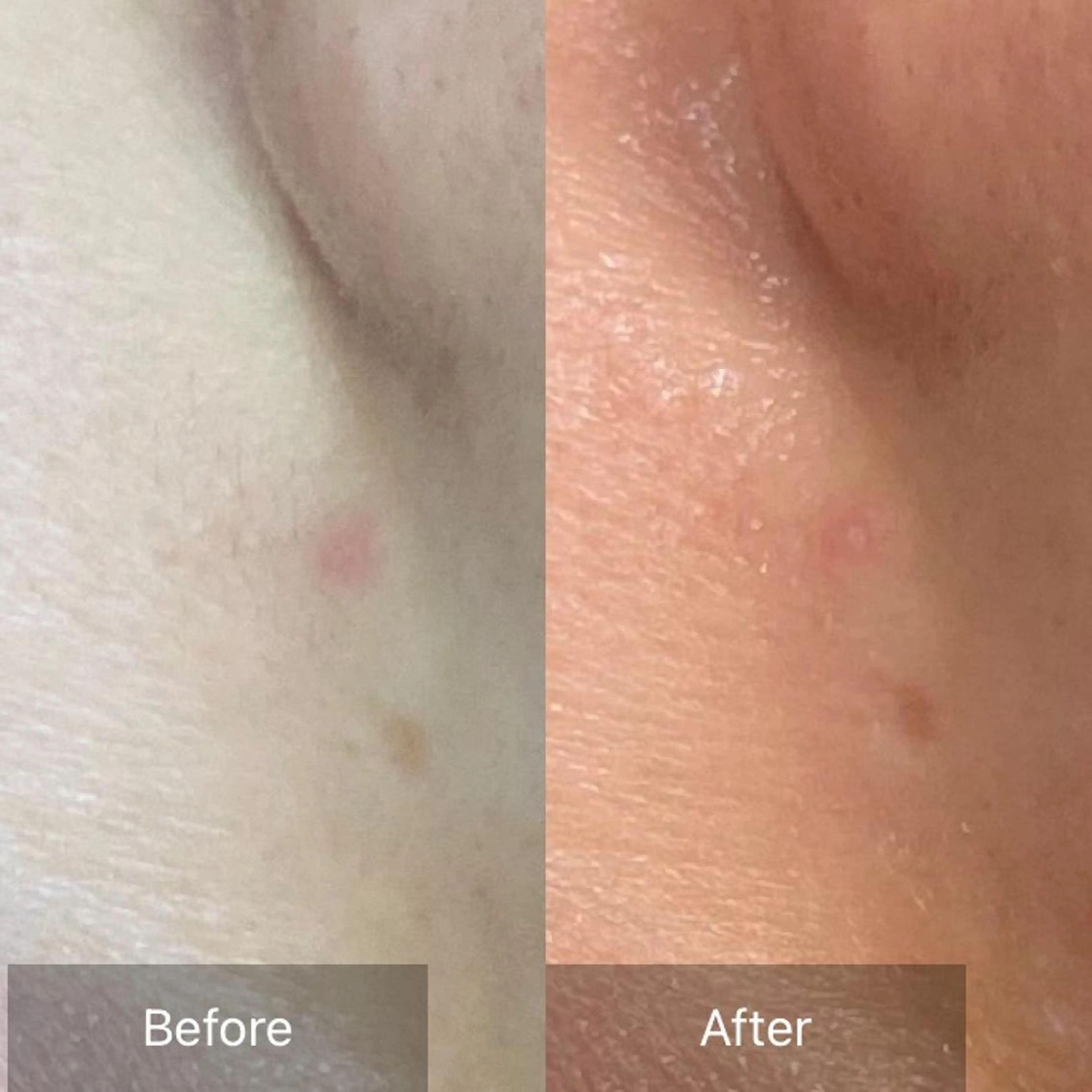 脱毛 産毛専門店 Bittoのエステ・リラクイメージ