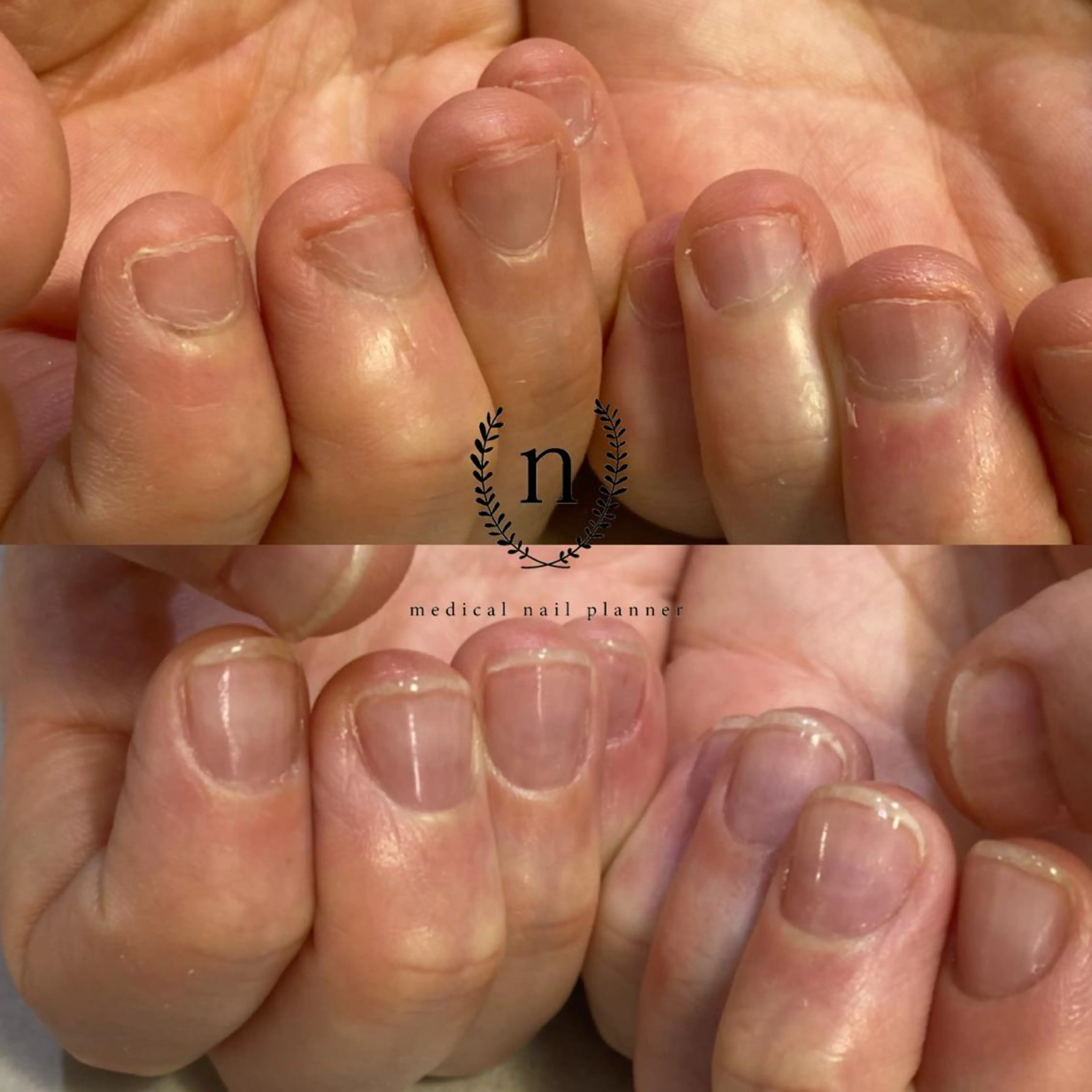 ネイル Rio 𓍼のネイルデザイン