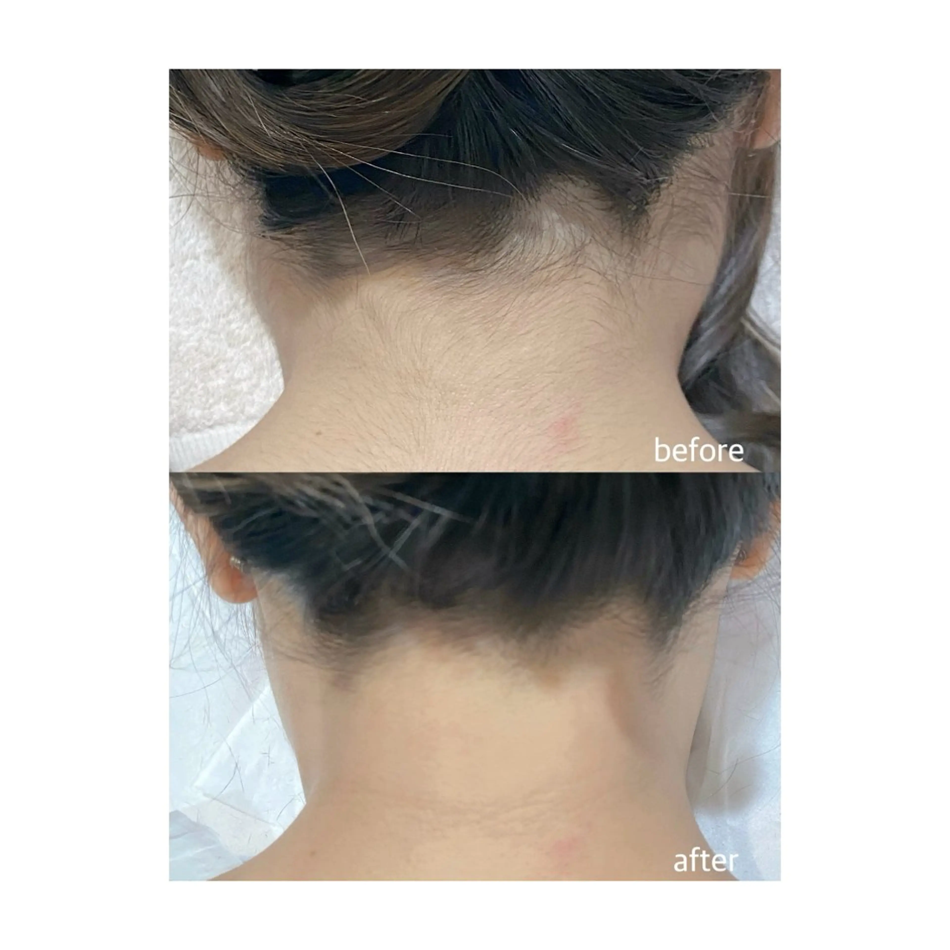 脱毛 M's Style NAIL BARのエステ・リラクイメージ