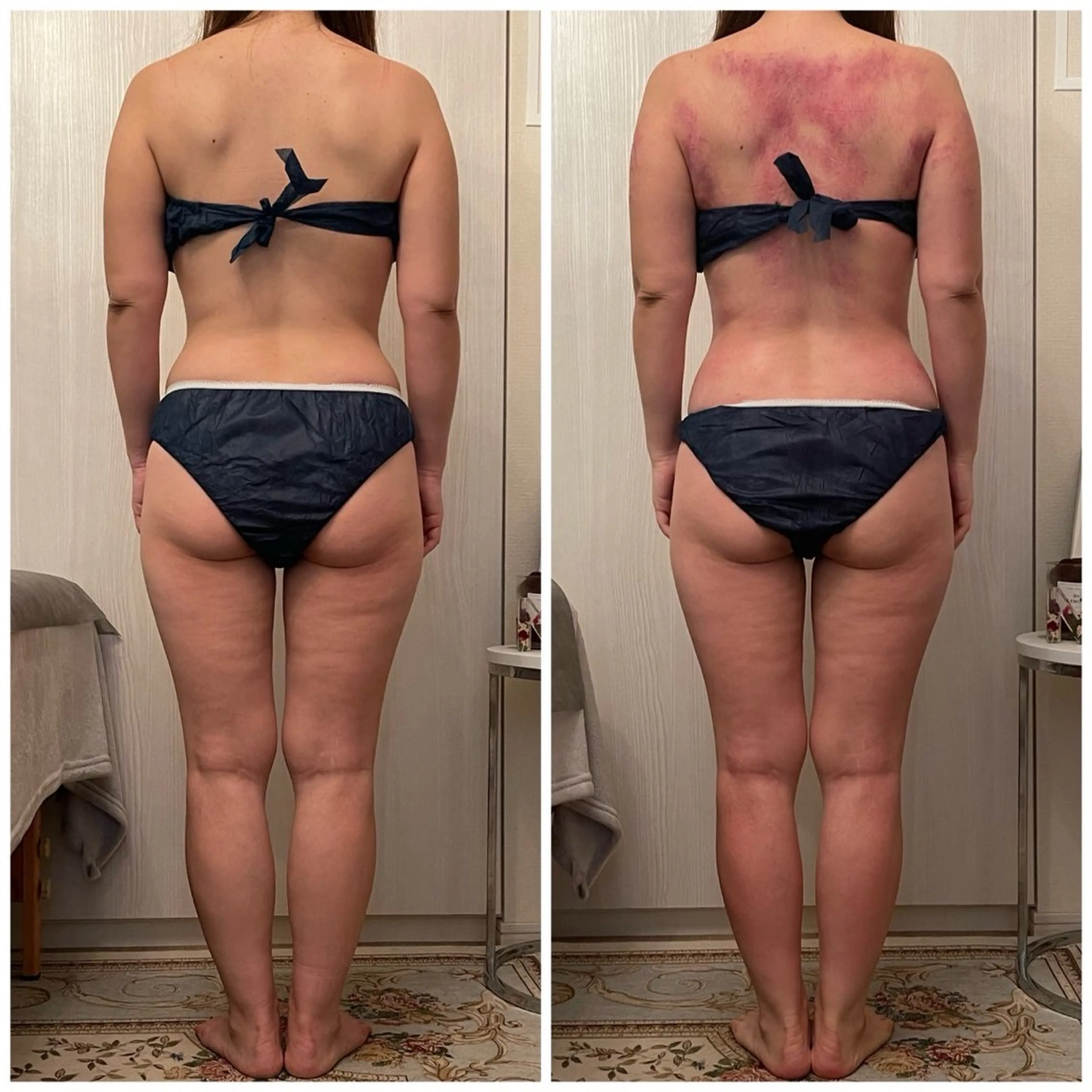 食べながら魅せボディ éclatJua川越のエステ・リラクイメージ