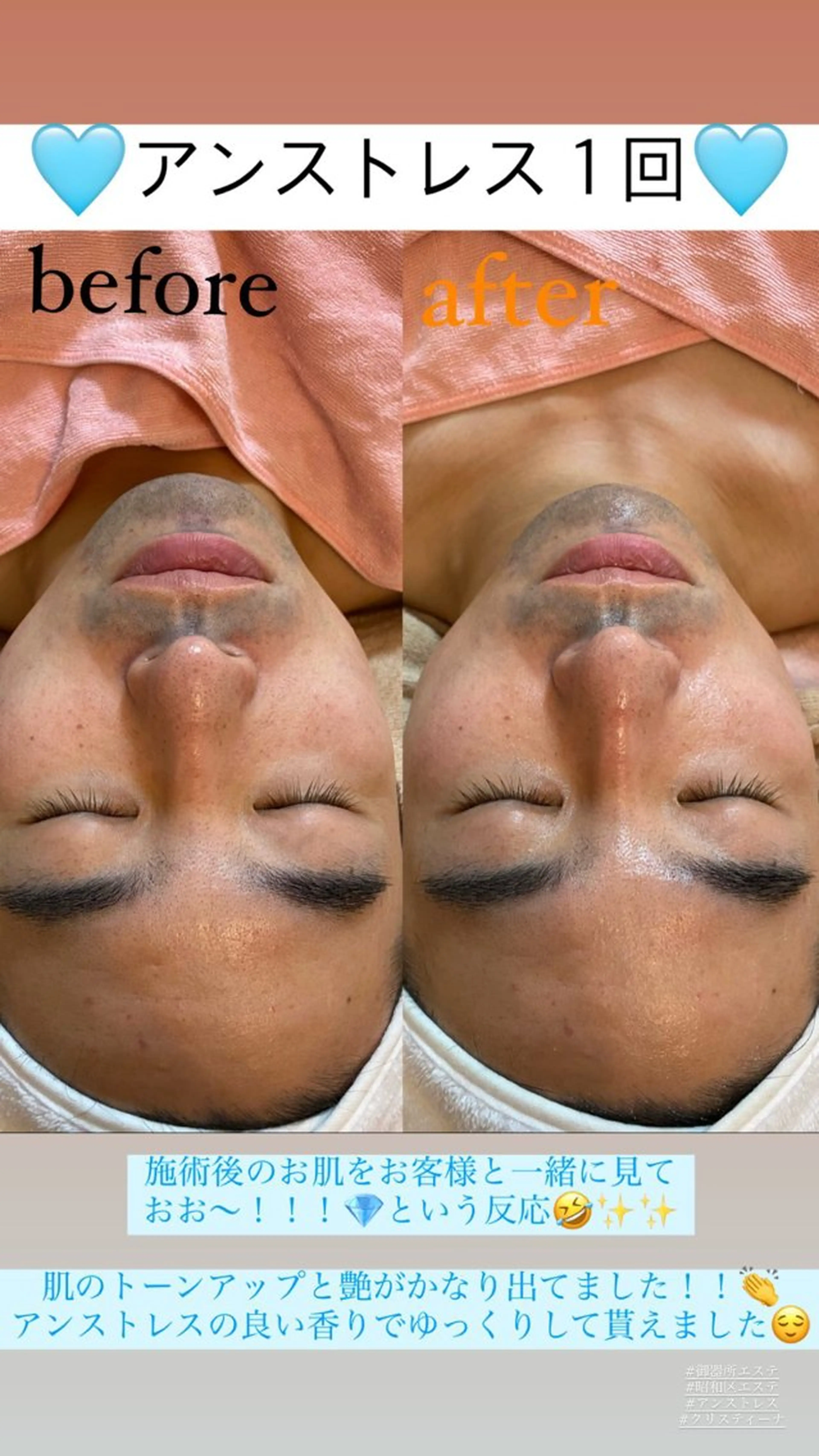 メンズ エステ Salon de Lino 御器所のエステ・リラクイメージ