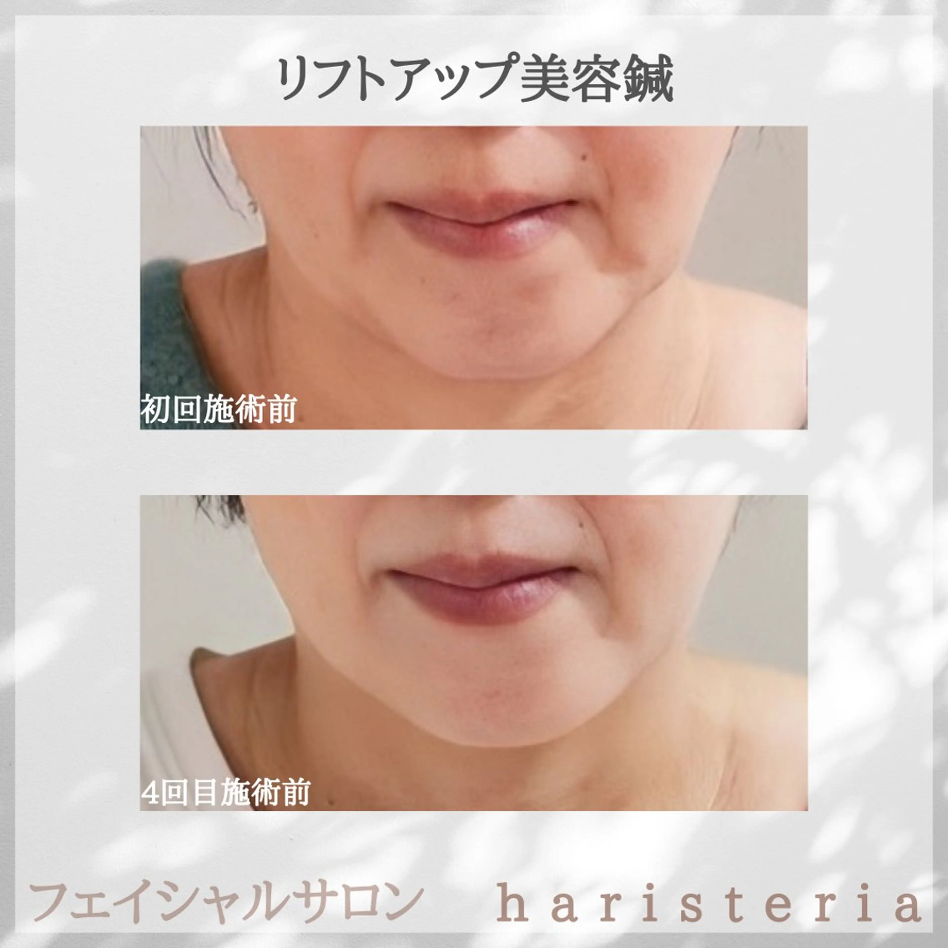 小顔・ツルツル素肌 ハリステリアのエステ・リラクイメージ