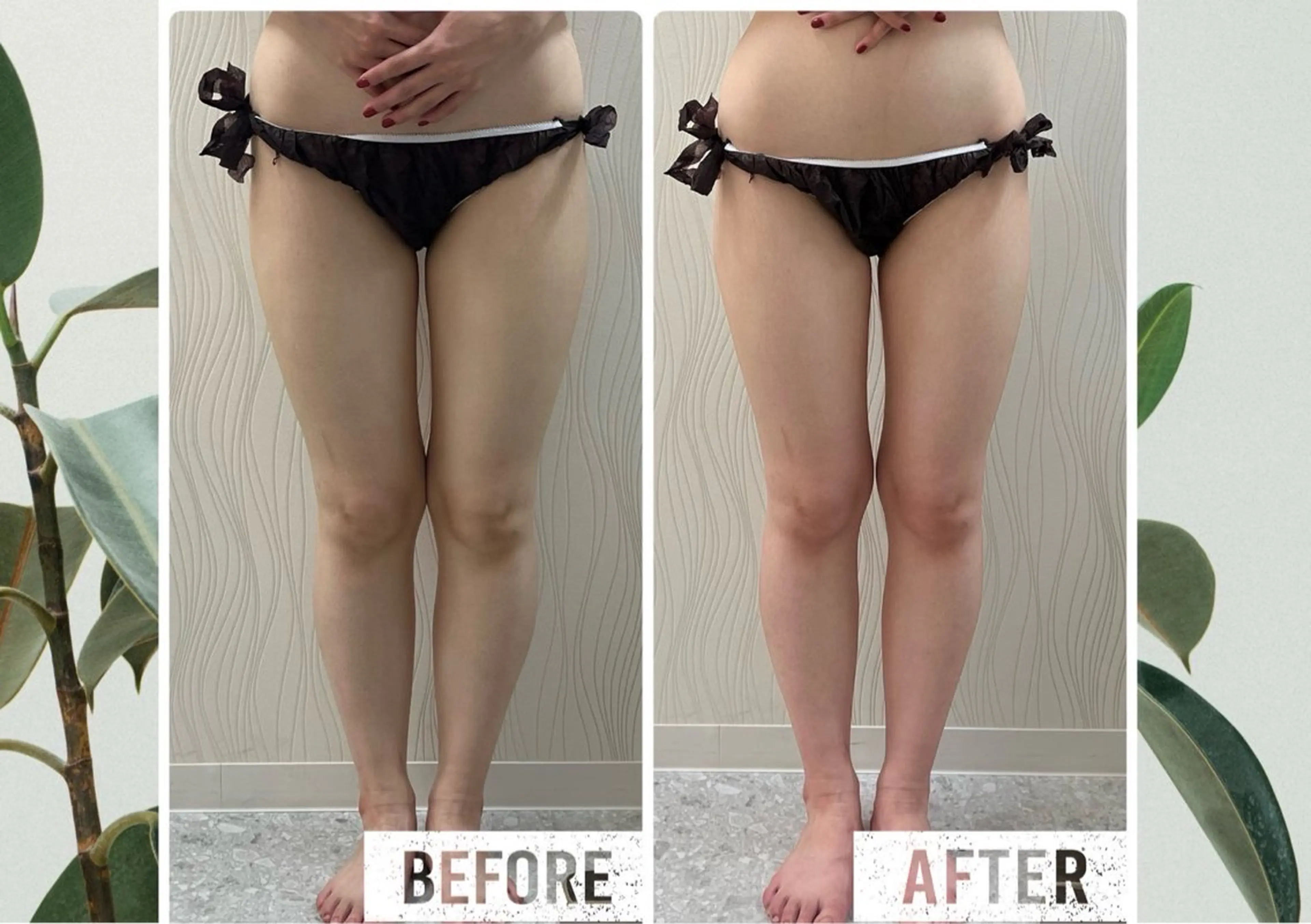 痩身・リラク KOZUEのエステ・リラクイメージ