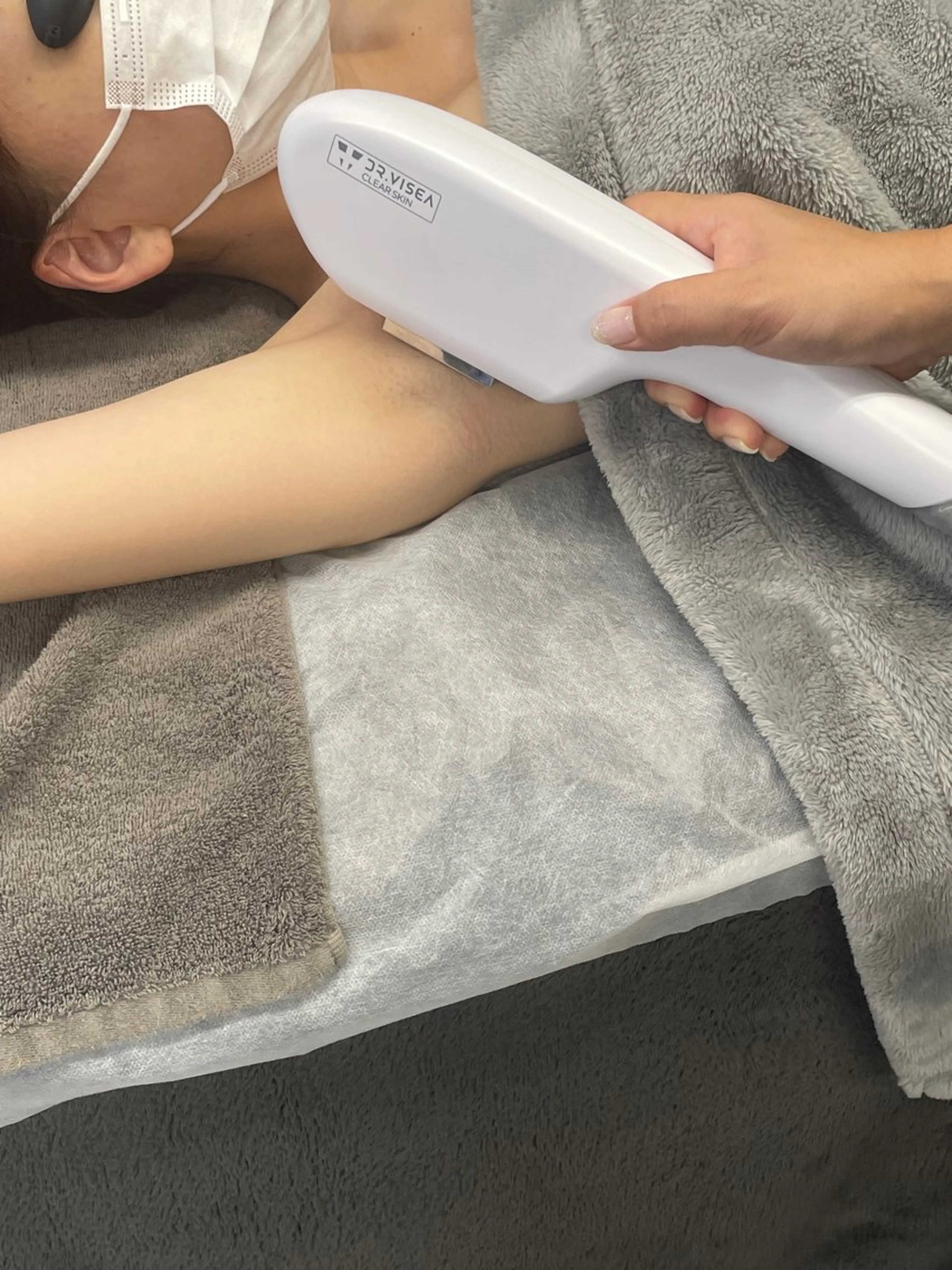 🎀 キレイの第一歩💖　両ワキ脱毛モデル募集✨5回 5000円✨の写真