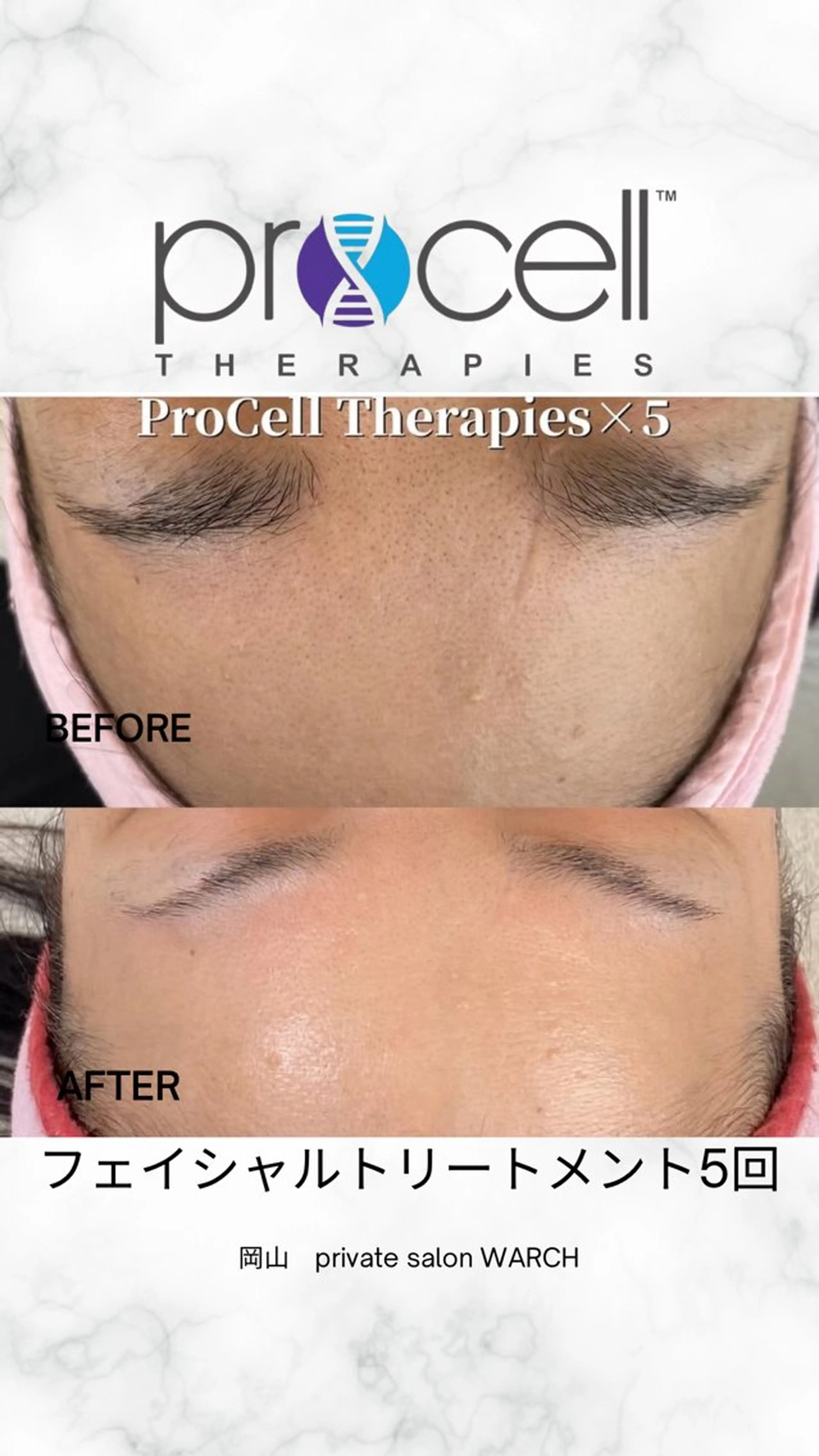 WARCH Marieのその他イメージ