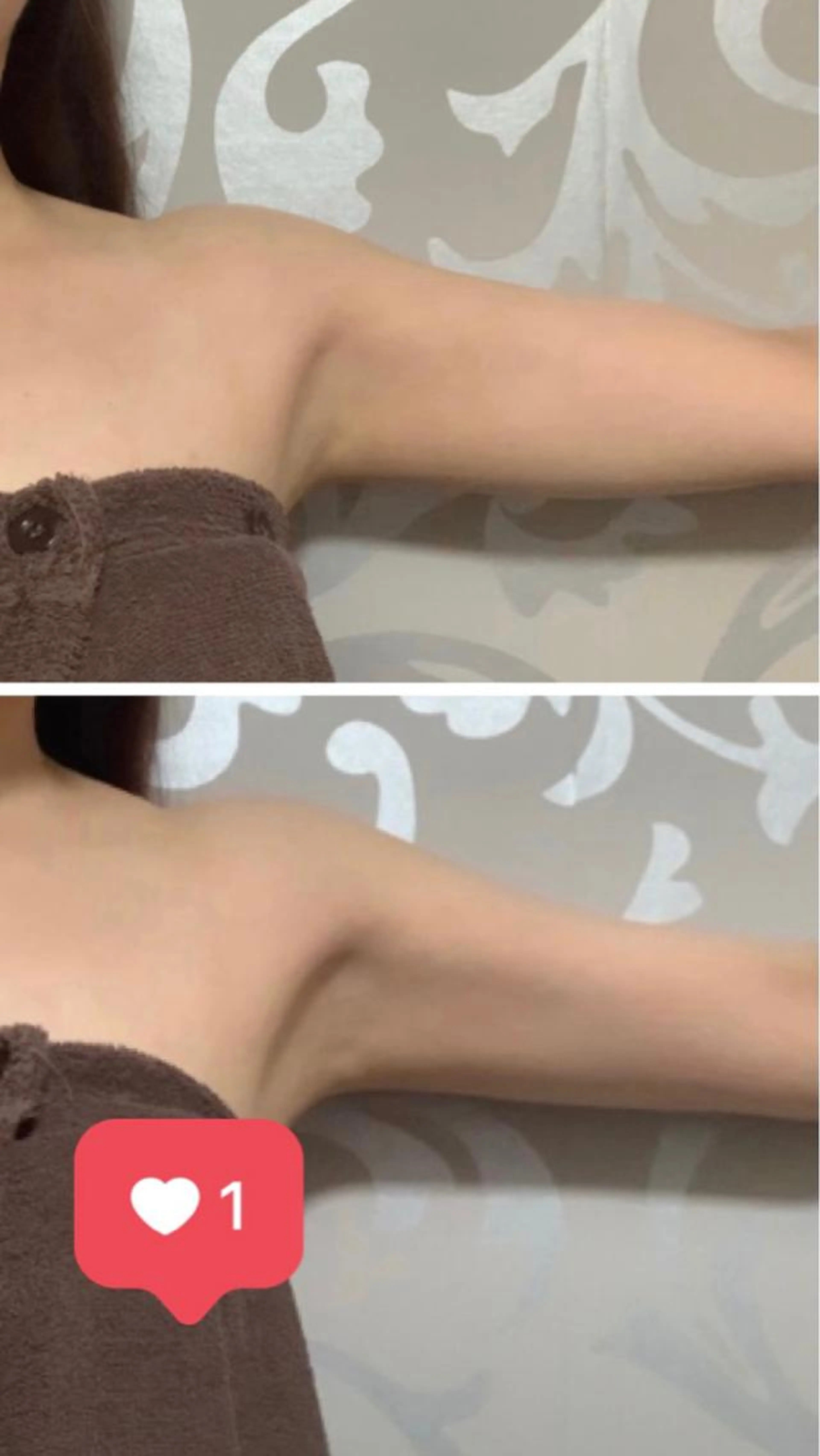 二の腕集中ケア20分の写真