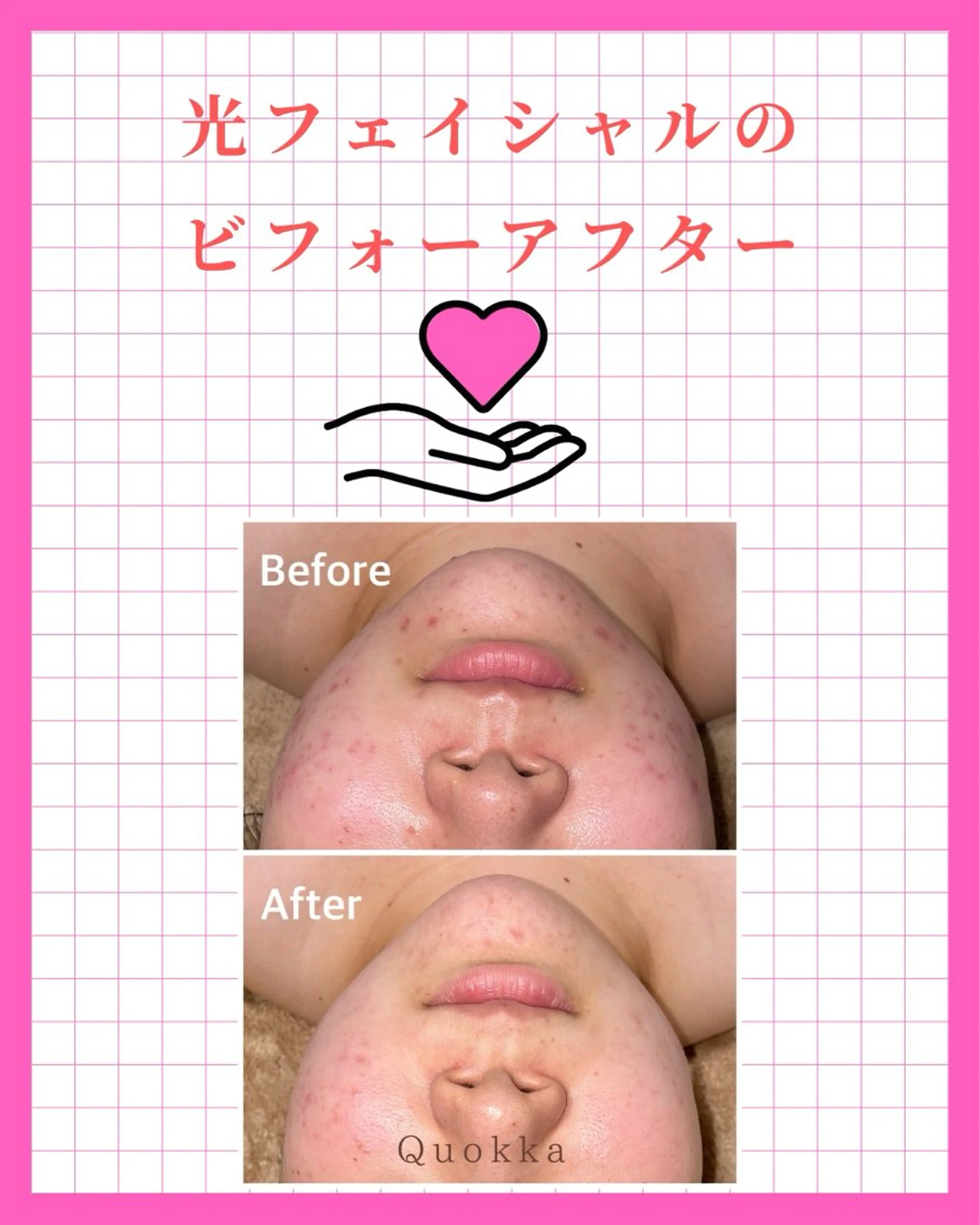 その他 Quokka ✴︎ あま市甚目寺のエステ・リラクイメージ