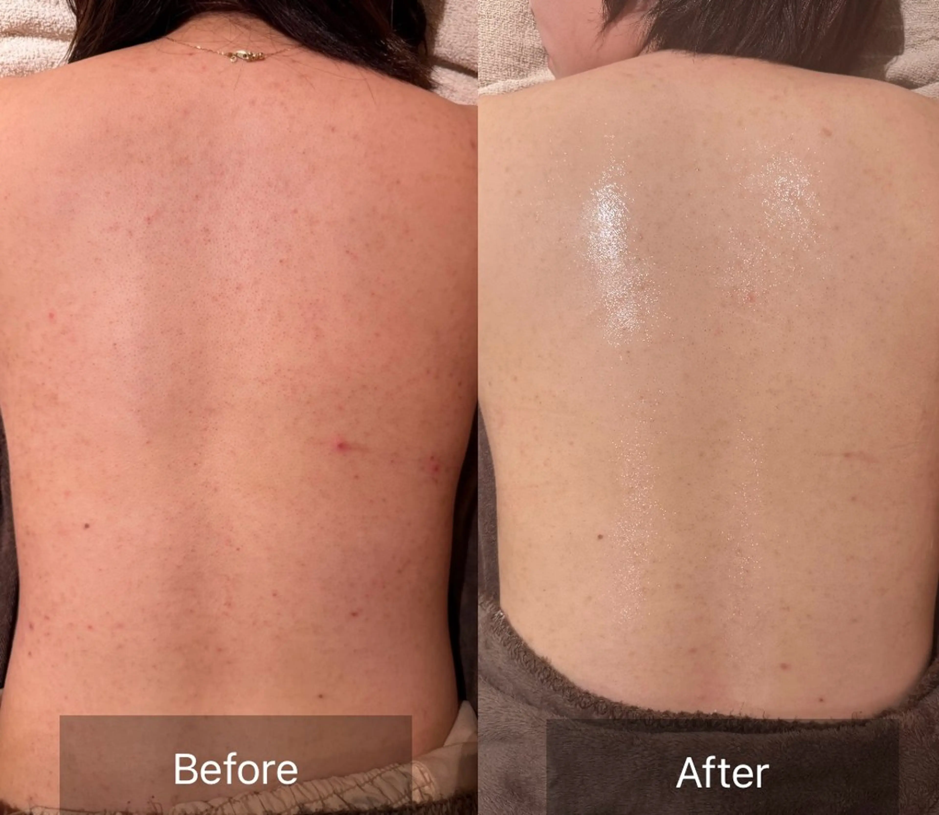 その他 for woman所属・森 美優のエステ・リラクイメージ