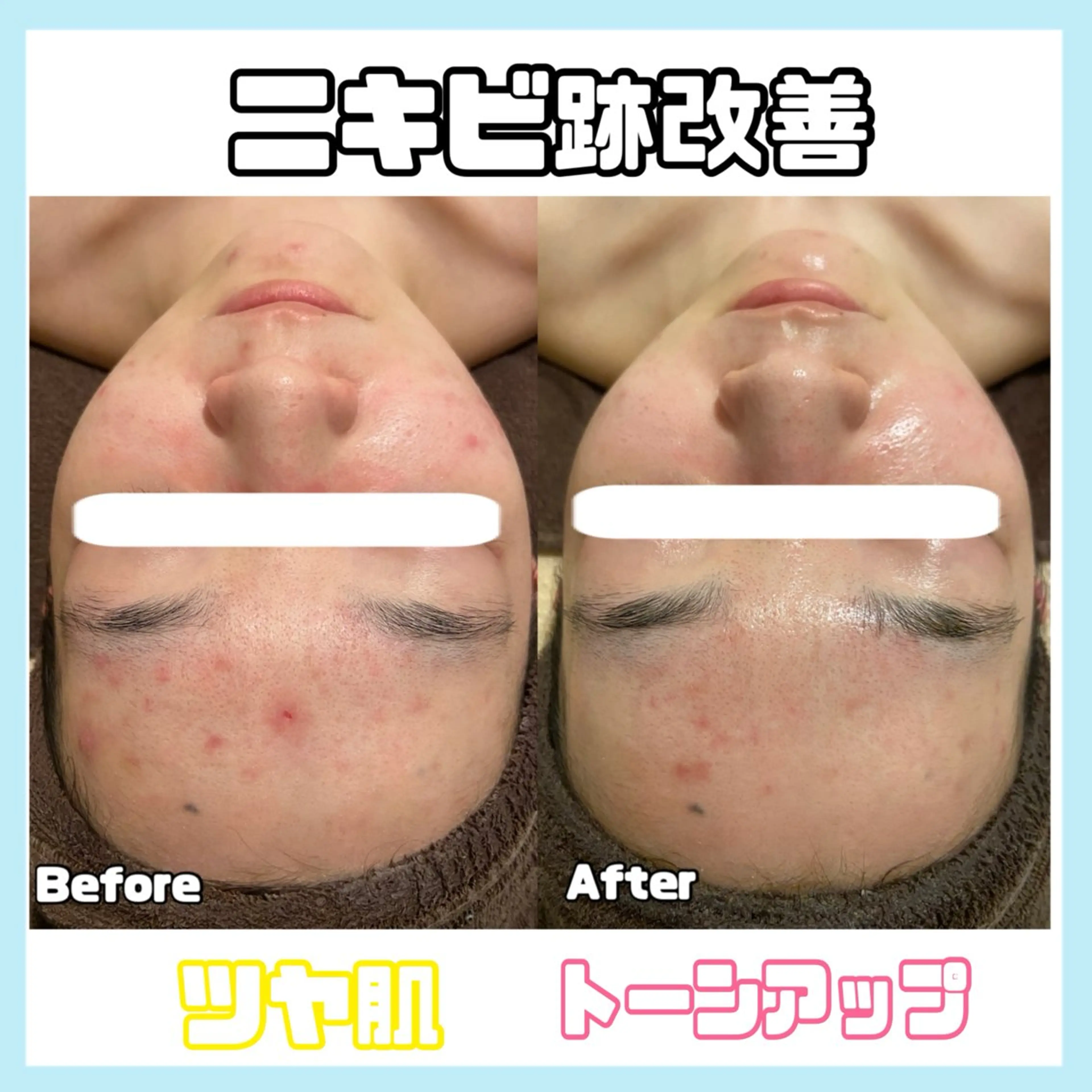 エステ オールハンド専門🤍 痩身/小顔/ ハーブのエステ・リラクイメージ