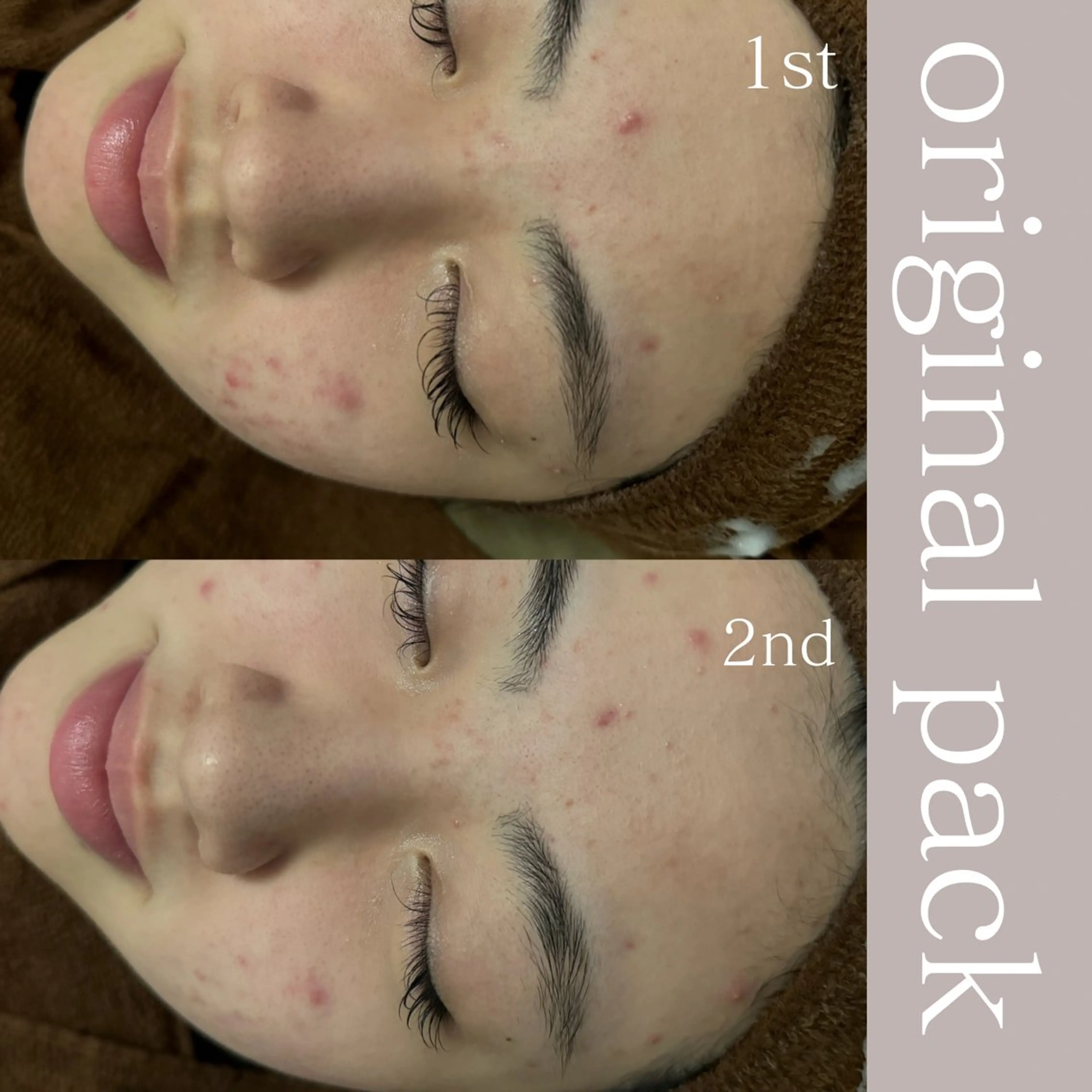 エステ 美肌salon GRAN CUORE所属・Natsuki🌙 GRAN CUOREのエステ・リラクイメージ