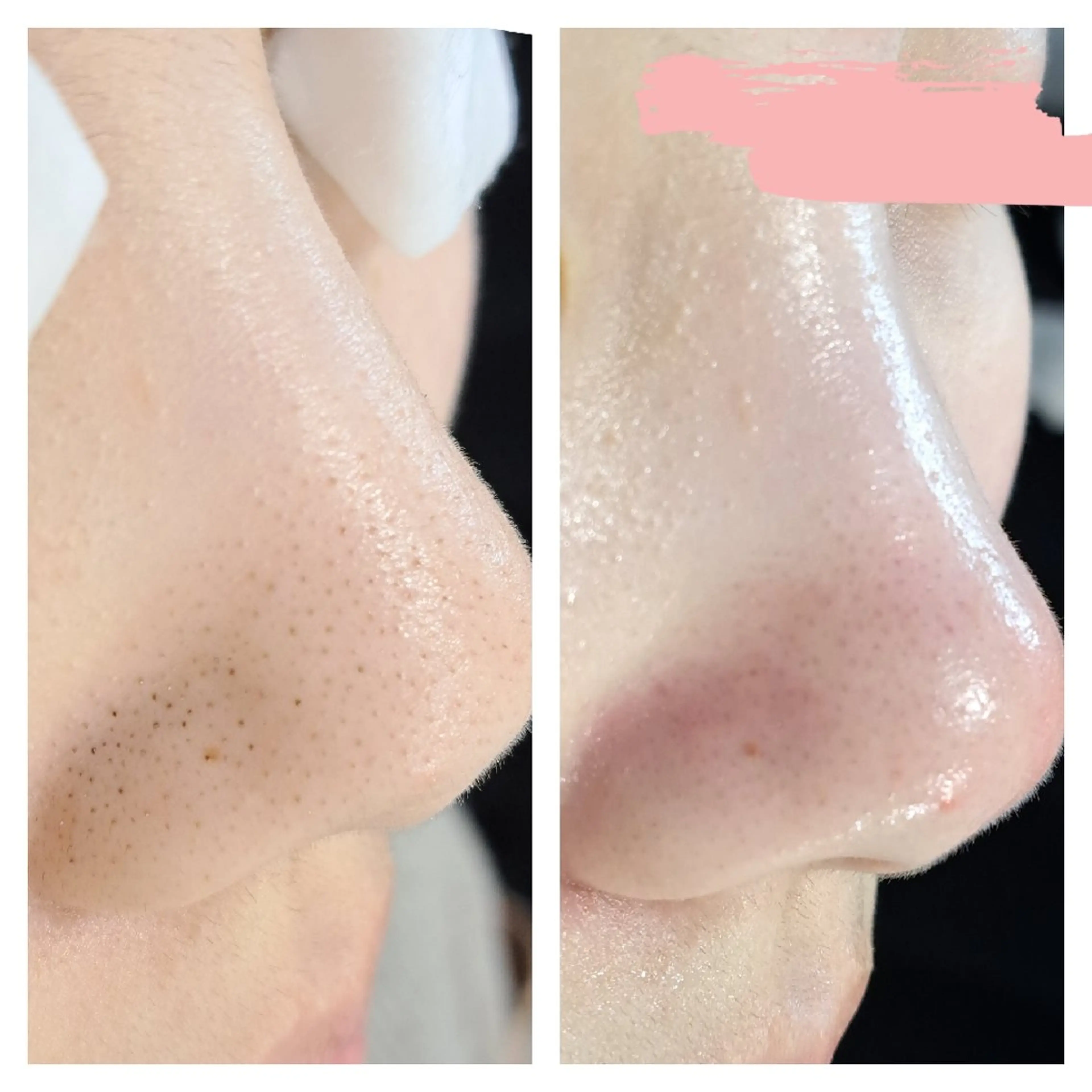 美肌脱毛サロン つるりと御殿場店所属・美肌脱毛サロン つるりとのその他イメージ