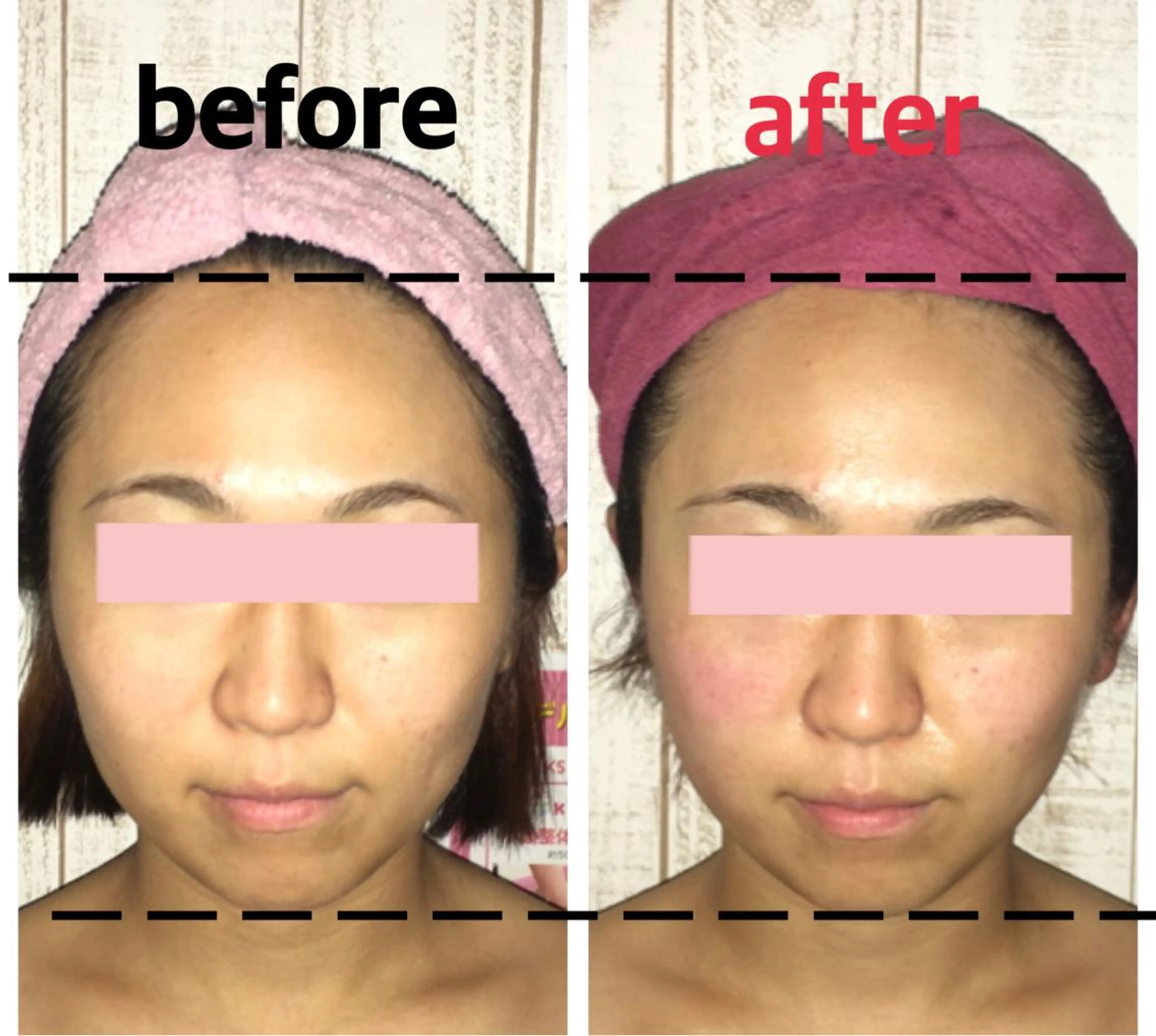 小顔プランナー辰巳 愛美のエステ・リラクイメージ