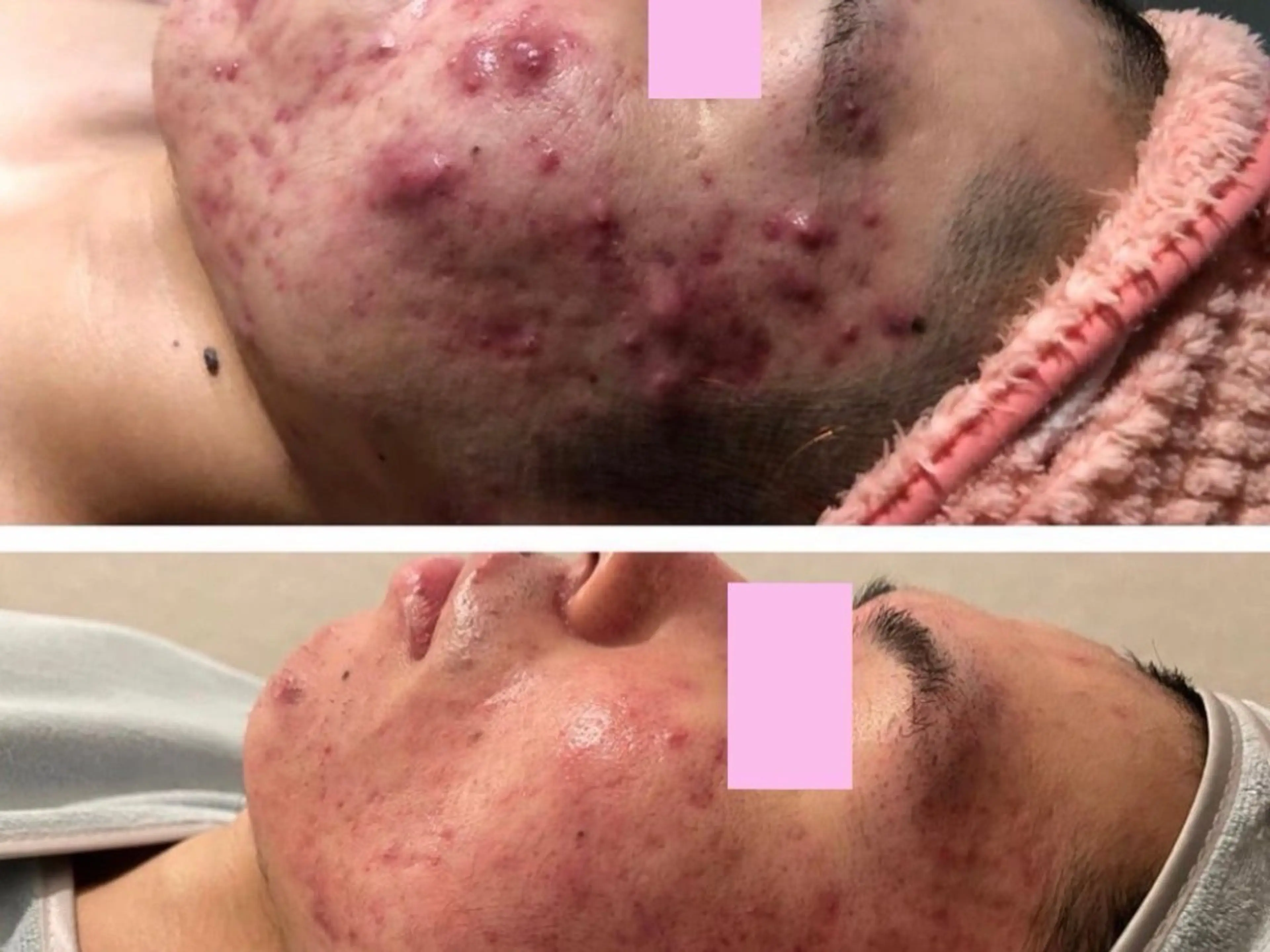 エステ 🌼SALON Lazuli久留米のエステ・リラクイメージ