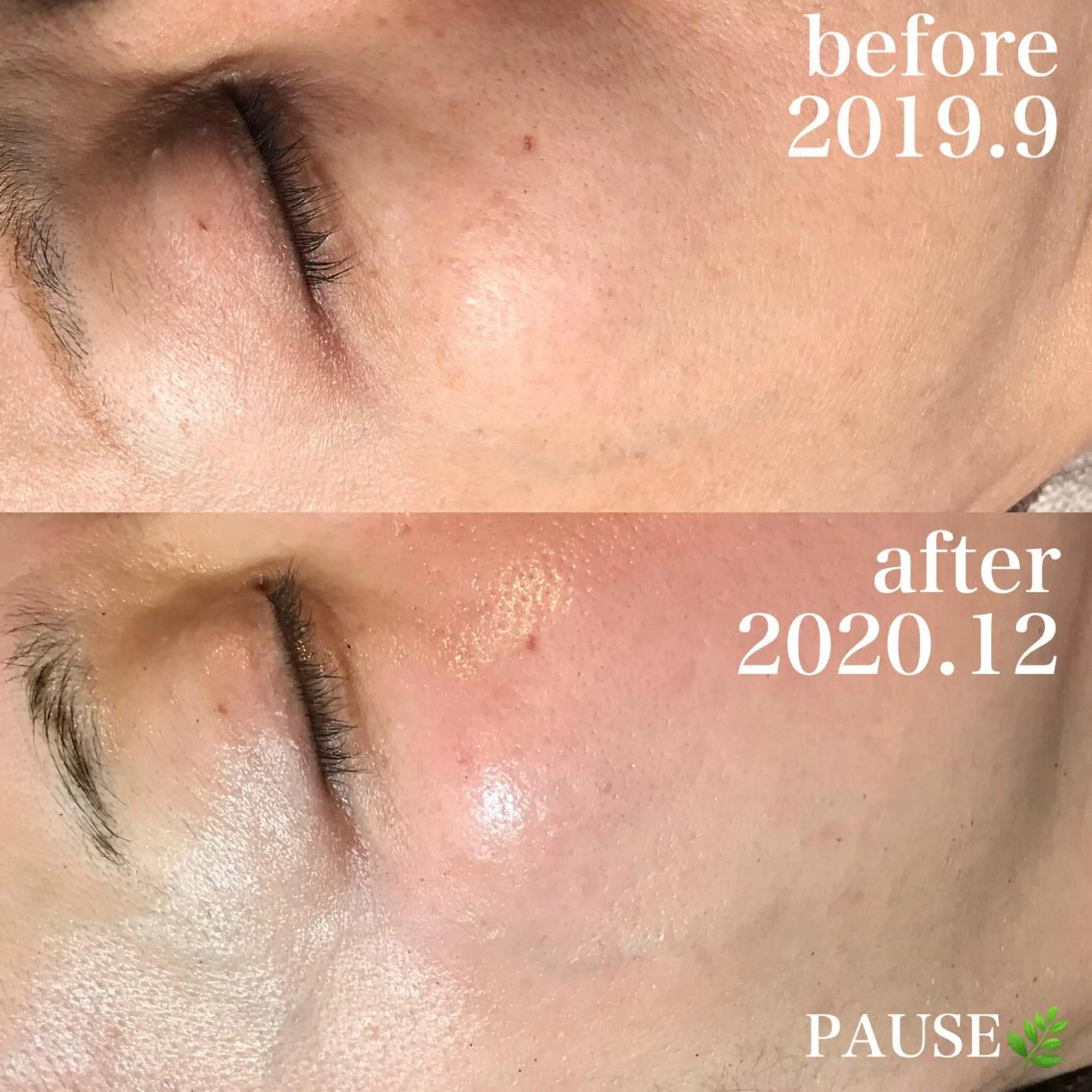 エステ 浜野 恵美のエステ・リラクイメージ