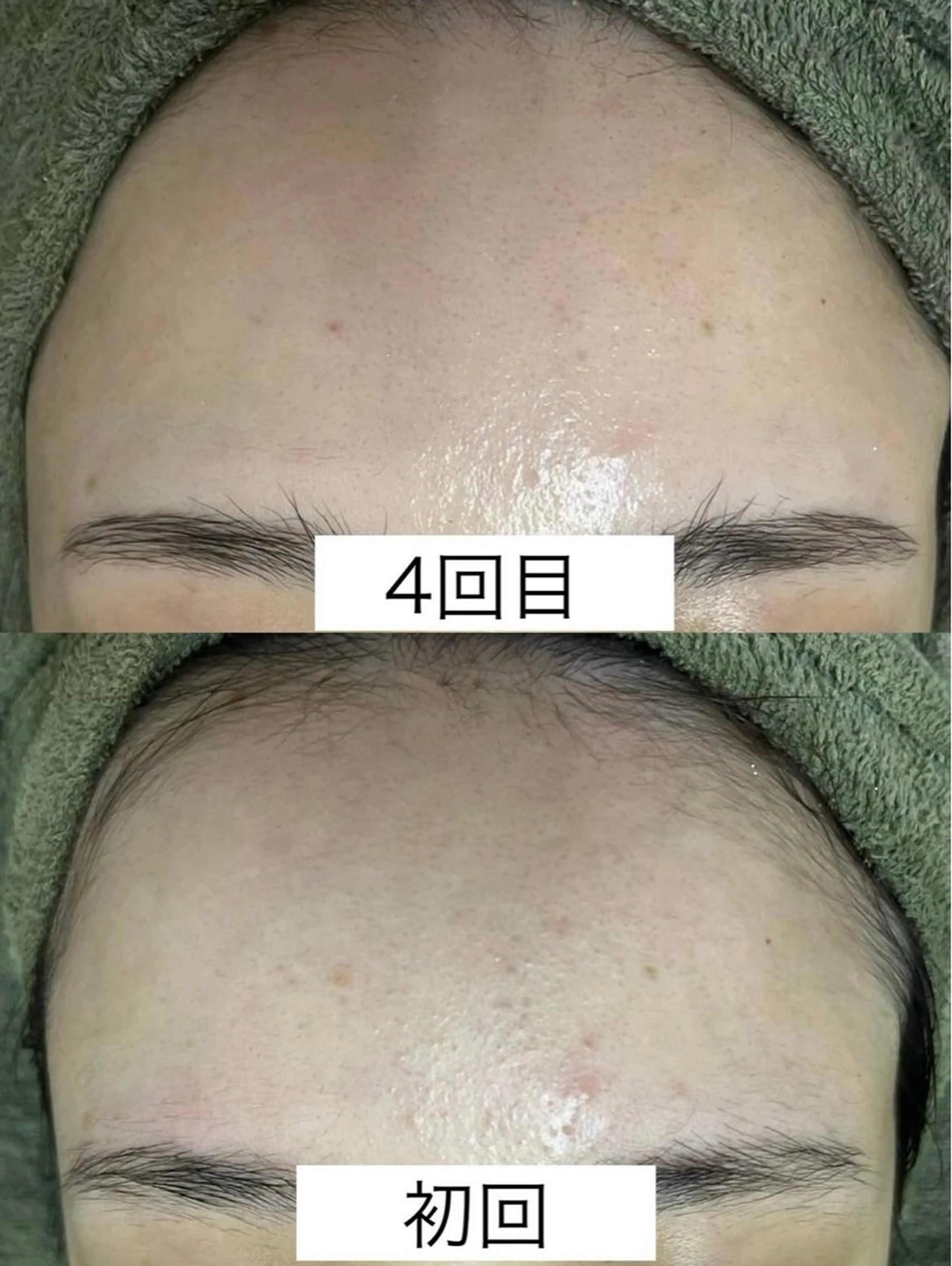 エステ 韓国美肌/肌質改善 【天神】yuiのエステ・リラクイメージ