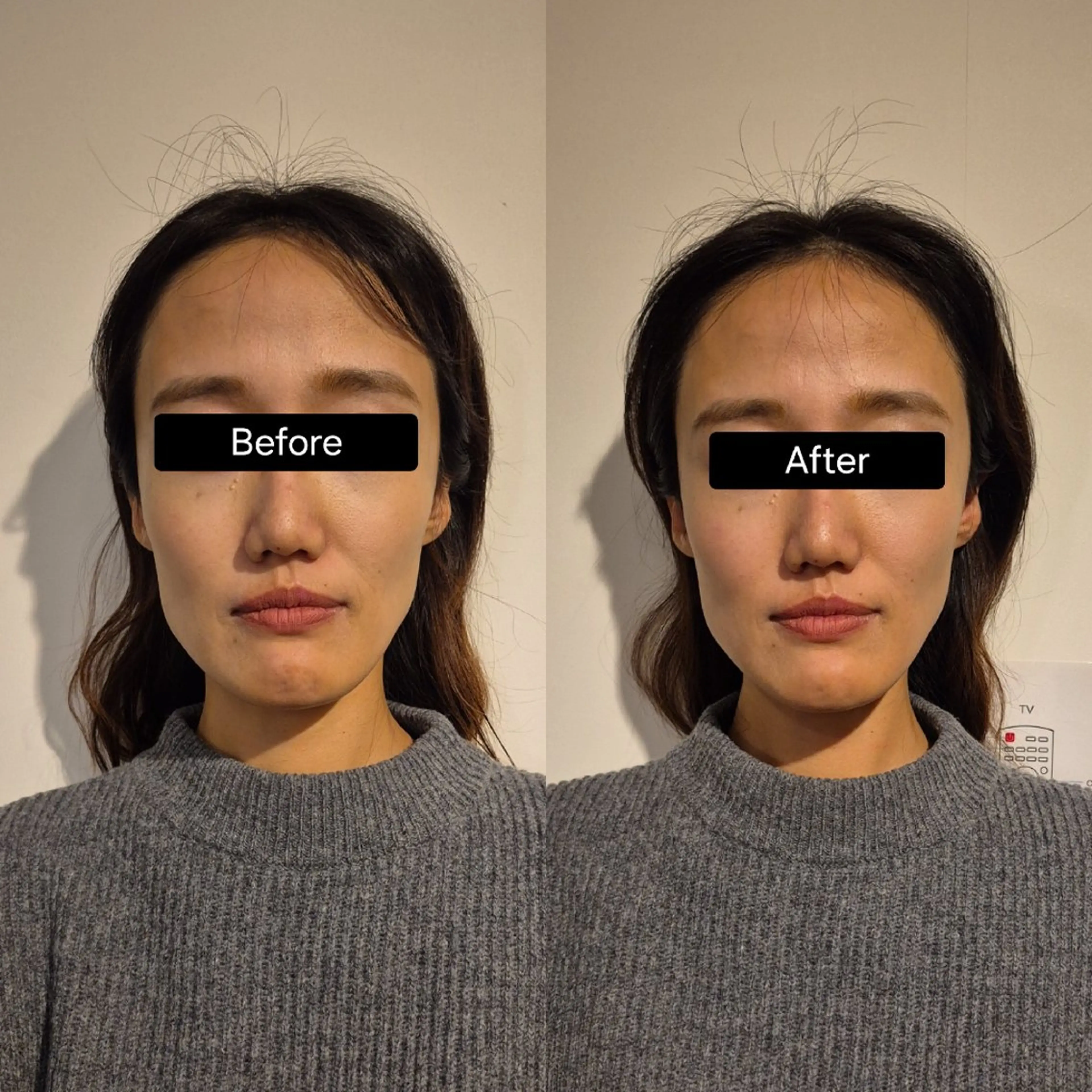 小顔矯正 LNのエステ・リラクイメージ