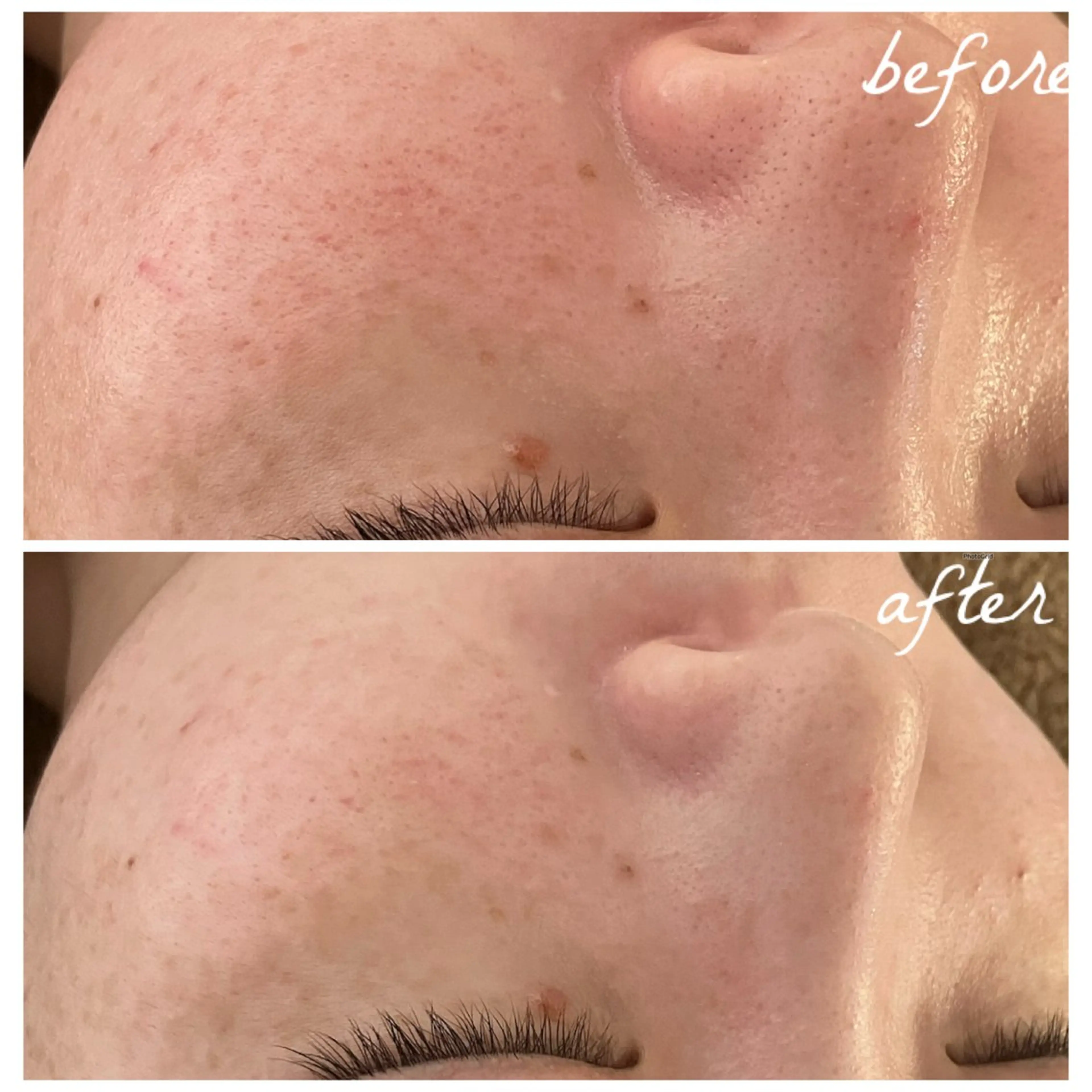 メンズ エステ メナード岐阜市茜部 杉浦のエステ・リラクイメージ