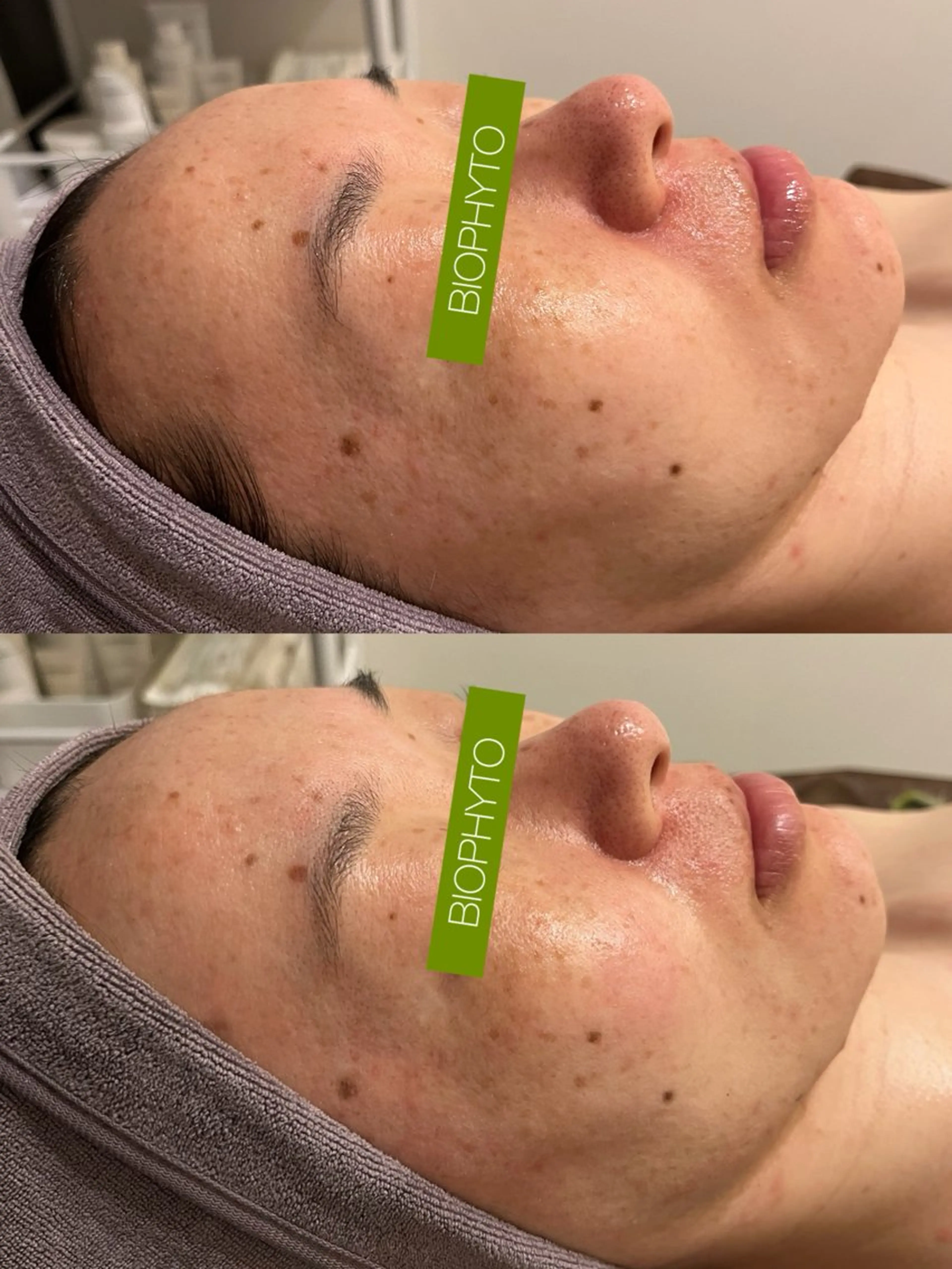 ☆痩身/小顔☆ コルギのエステ・リラクイメージ