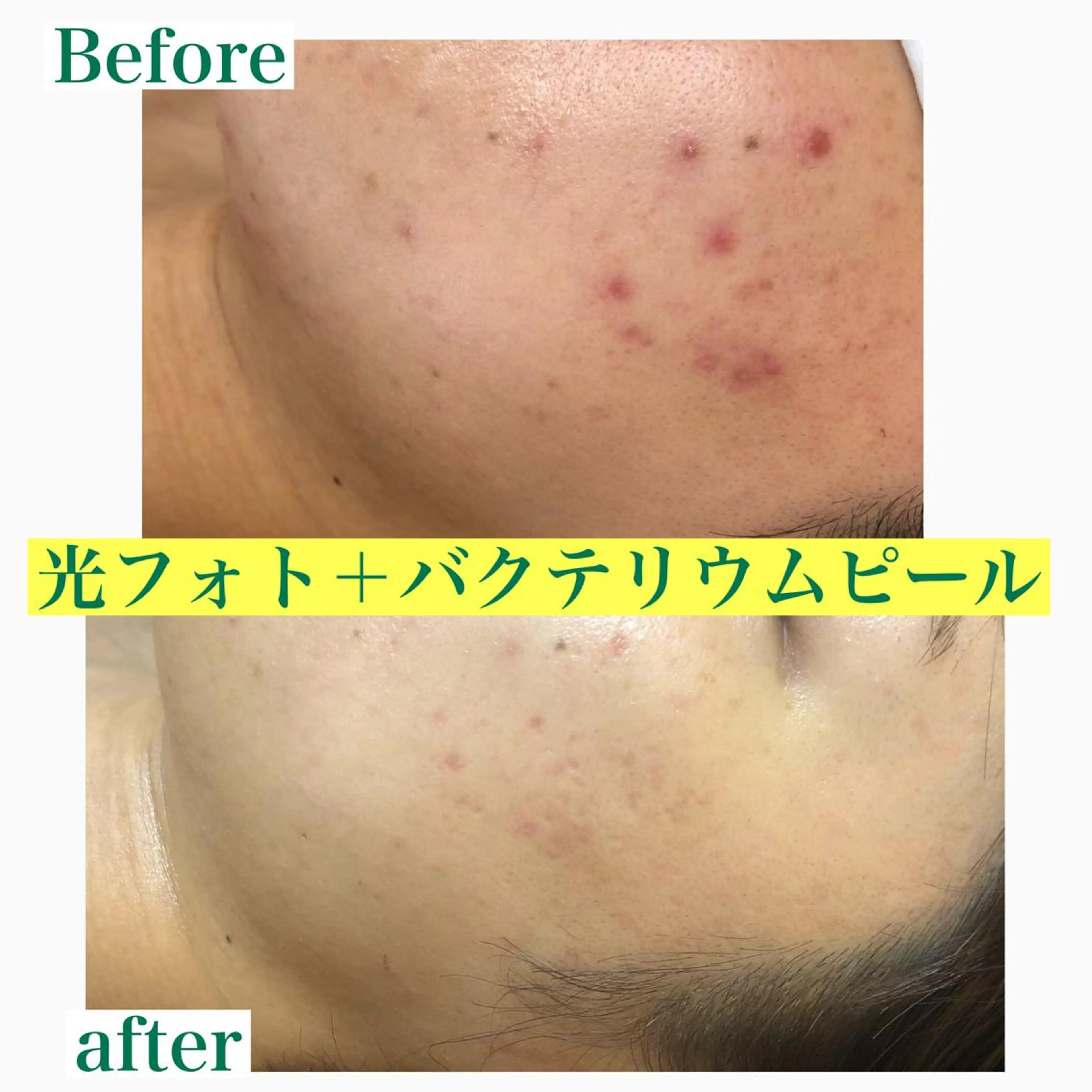 美肌脱毛と癒しのﾌﾟﾗｲﾍﾞｰﾄｻﾛﾝ。gratia~ｸﾞﾚｲﾃｨｱ~所属・gratia ~ｸﾞﾚｲﾃｨｱ~のエステ・リラクイメージ