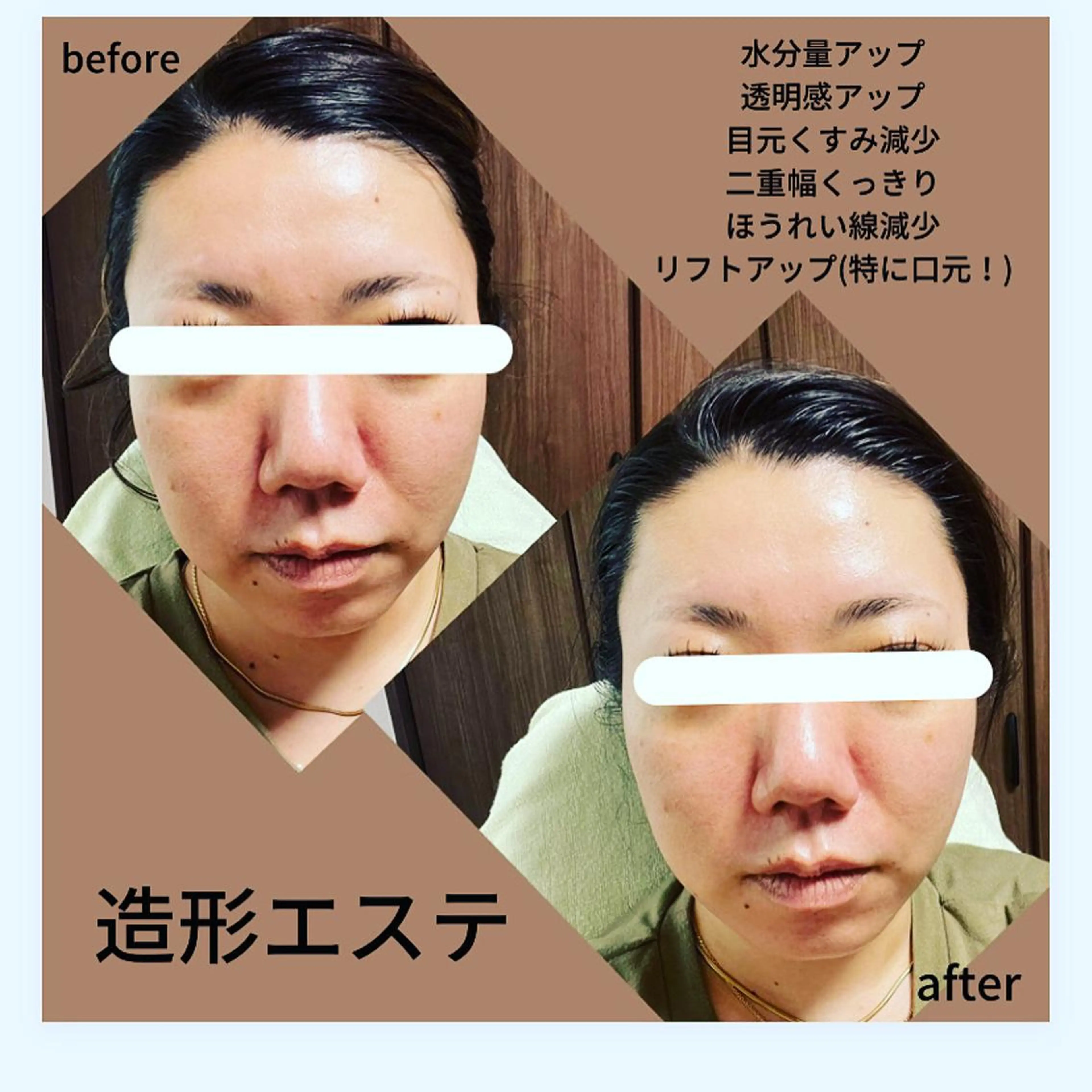 ミューズエステ 谷口美結のエステ・リラクイメージ