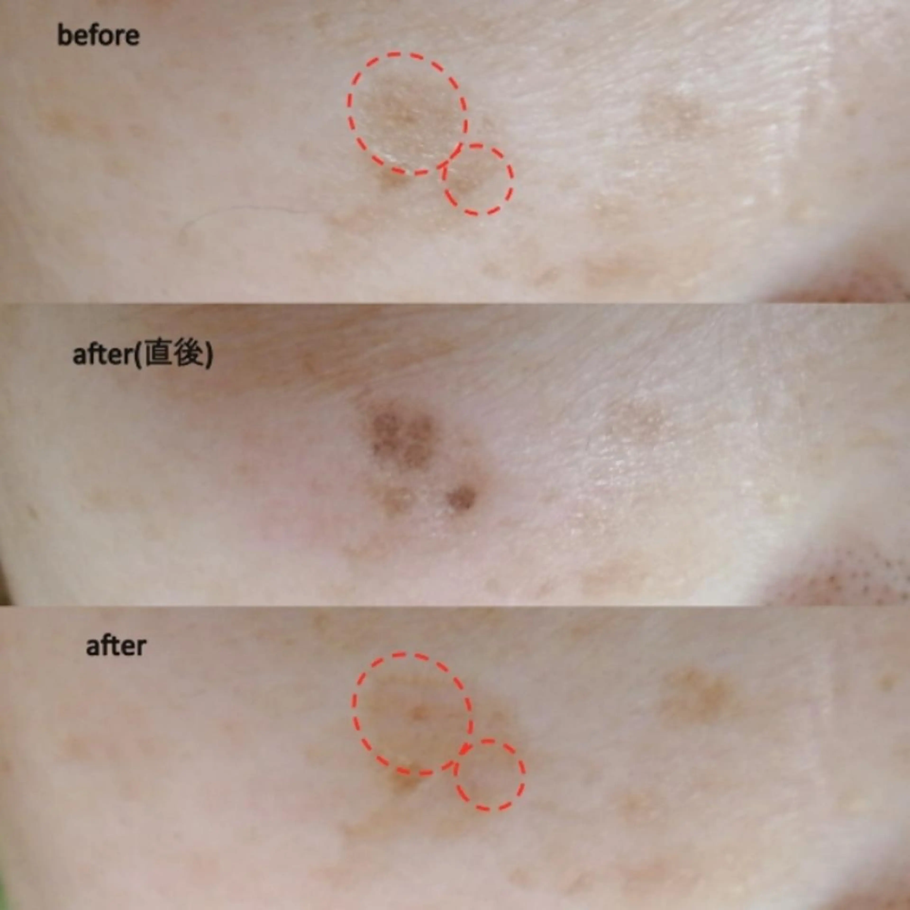 エステ  lafraise 田邉 里香のエステ・リラクイメージ