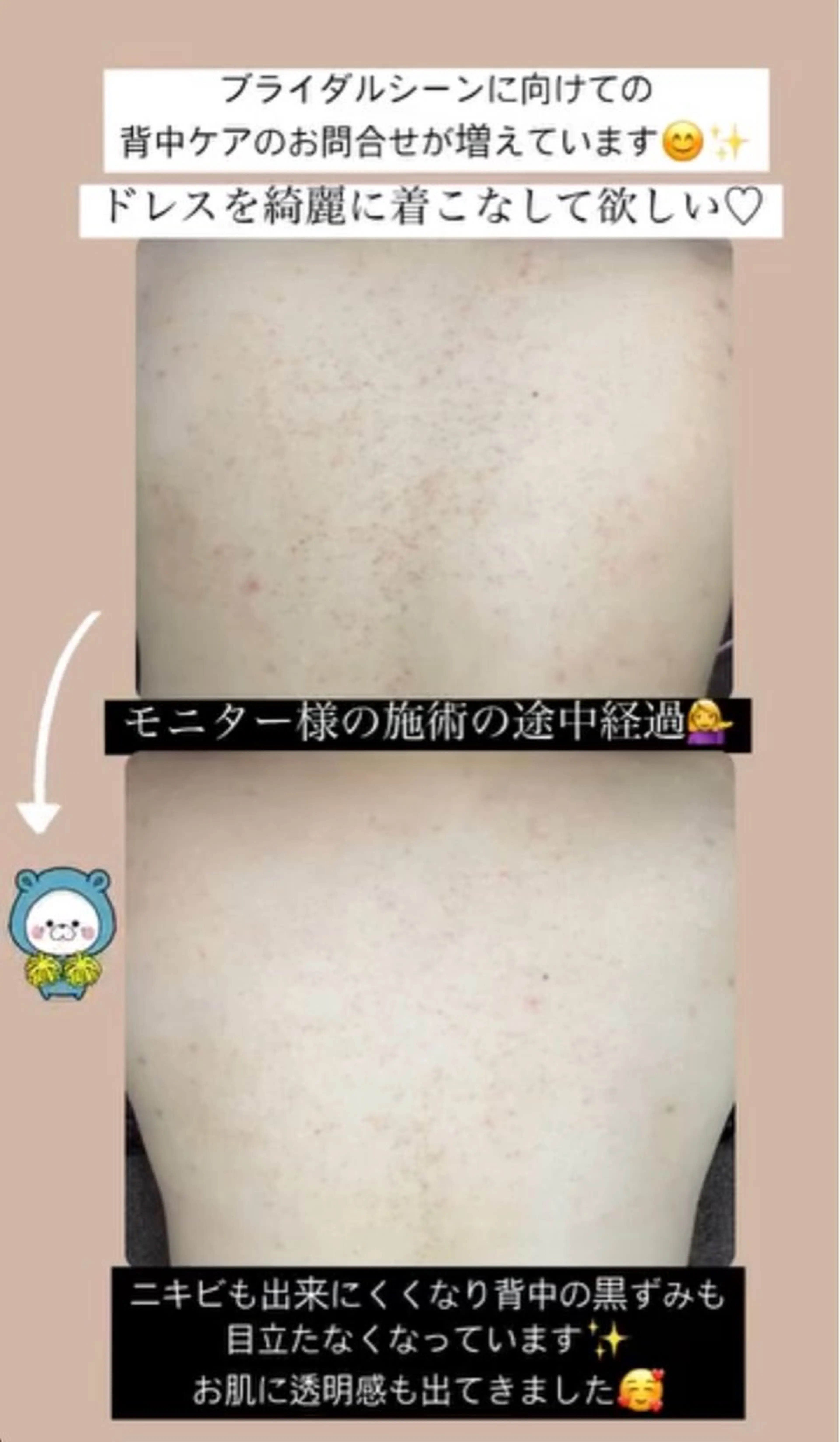 エステ ベラージュ【美背中・ 美尻・フェイシャル】のエステ・リラクイメージ