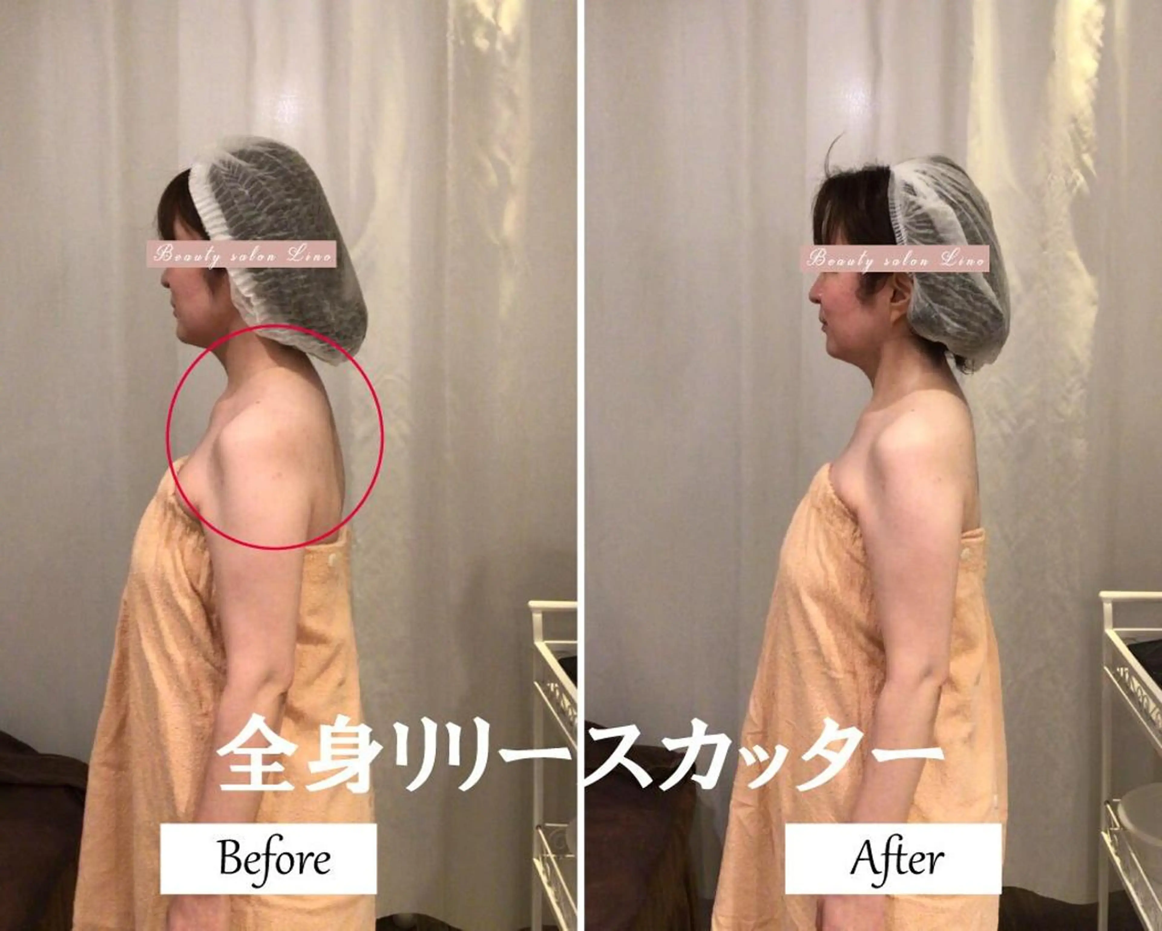 ブライダルサロン ｜Lino【堀江】のエステ・リラクイメージ