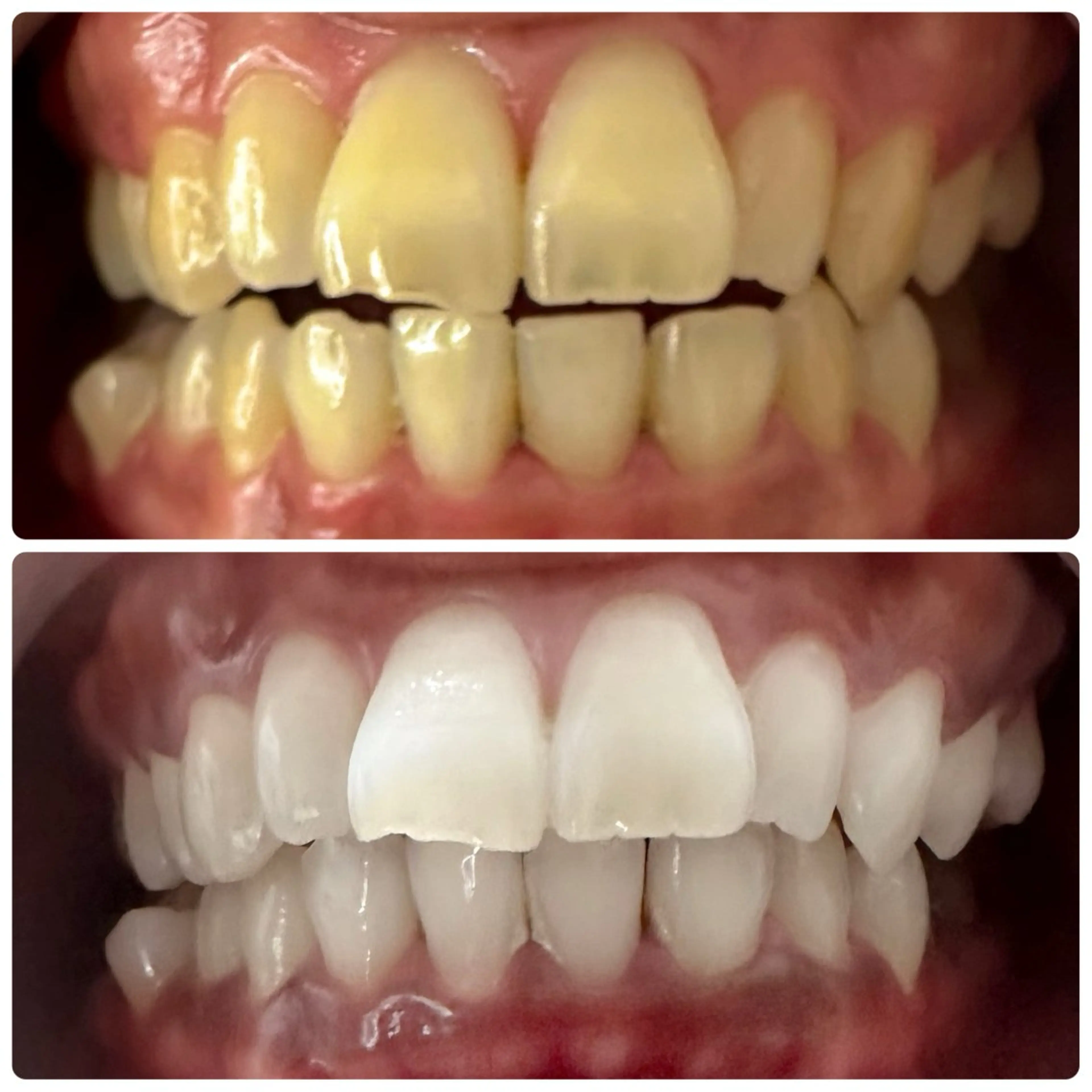 歯のホワイトニング専門店＆white所属・歯のホワイトニング 専門店&whiteのその他イメージ