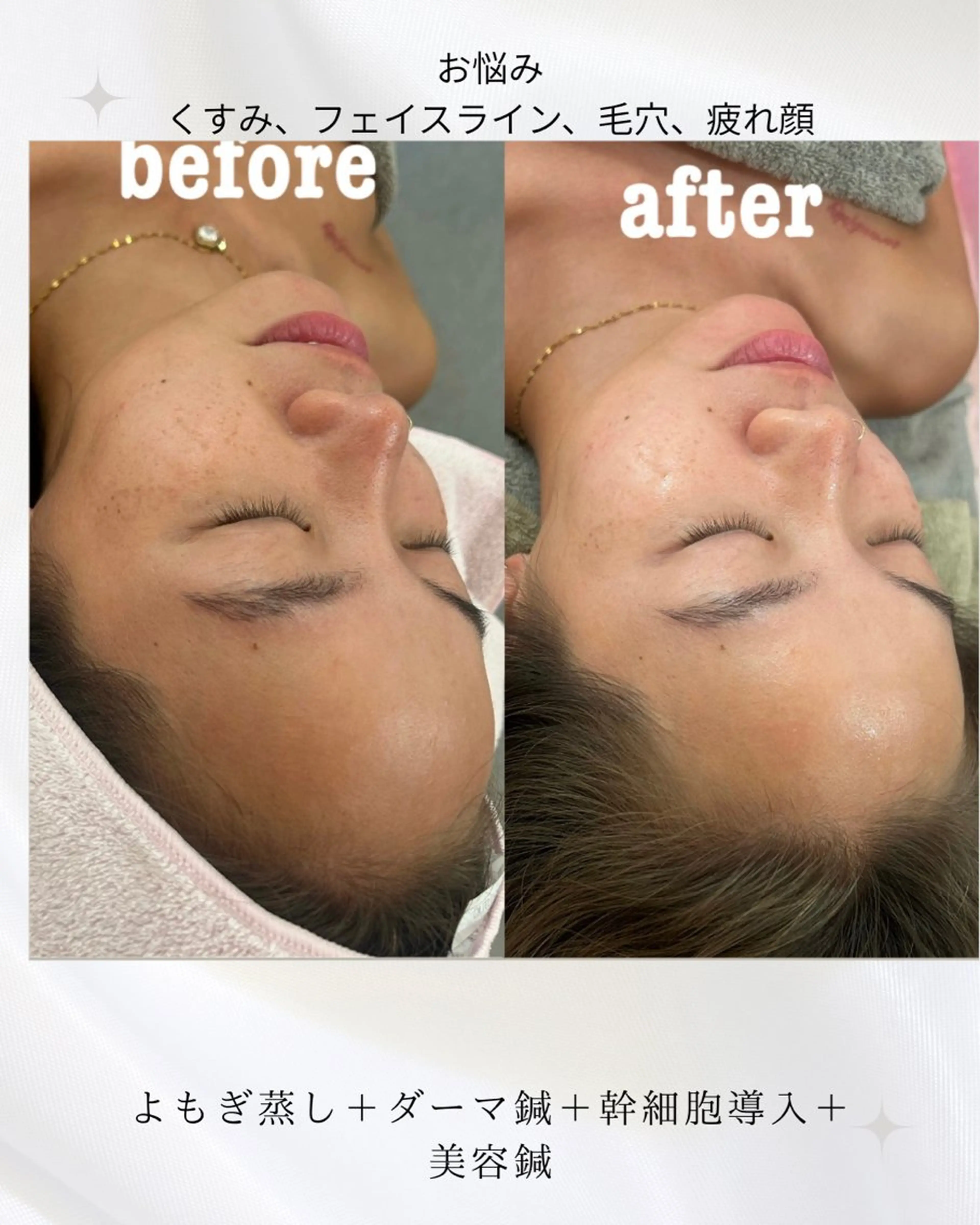 エステ リラク 美容鍼灸サロン mahoroba院長のエステ・リラクイメージ