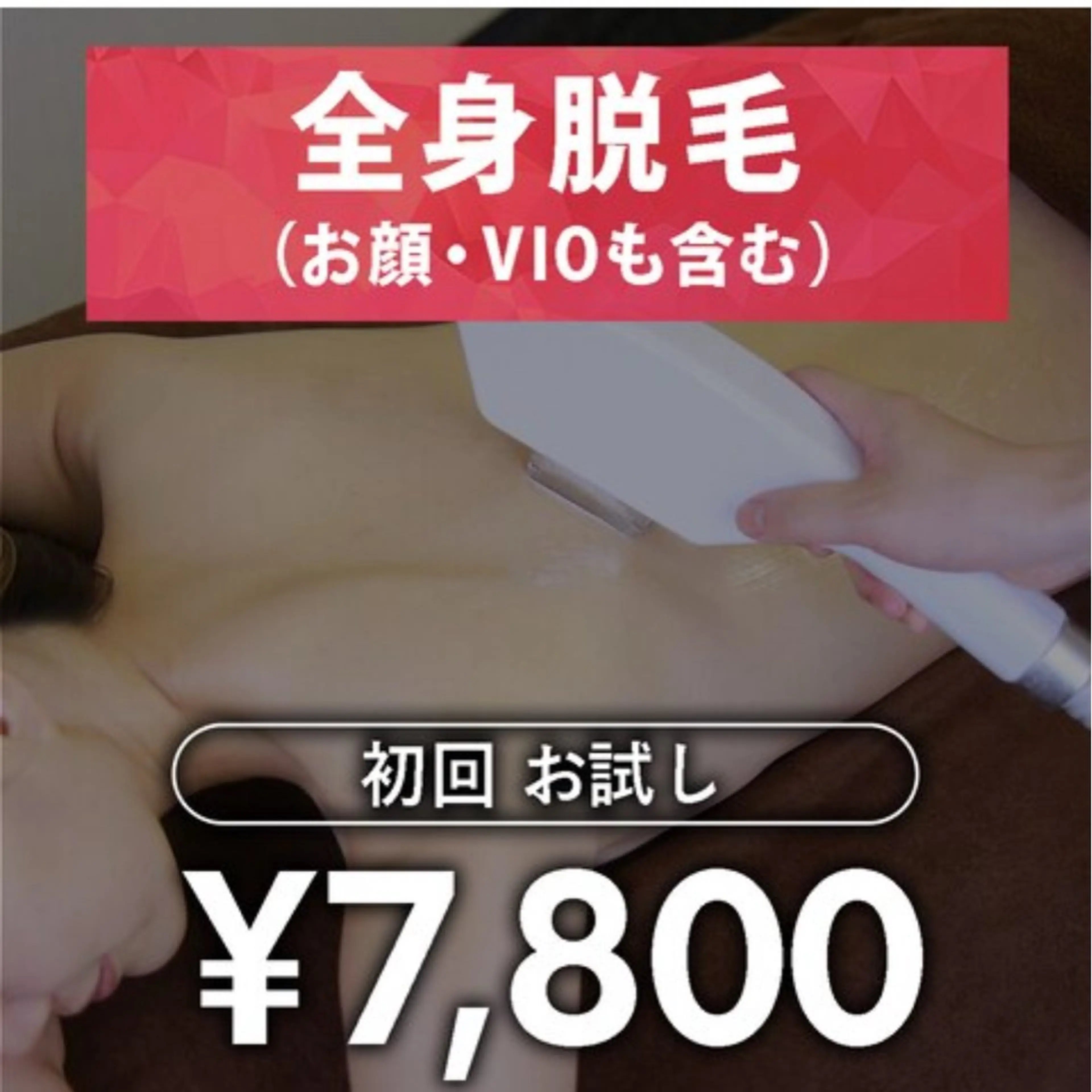 女性全身脱毛お試し7800円税込VIOお顔含むの写真