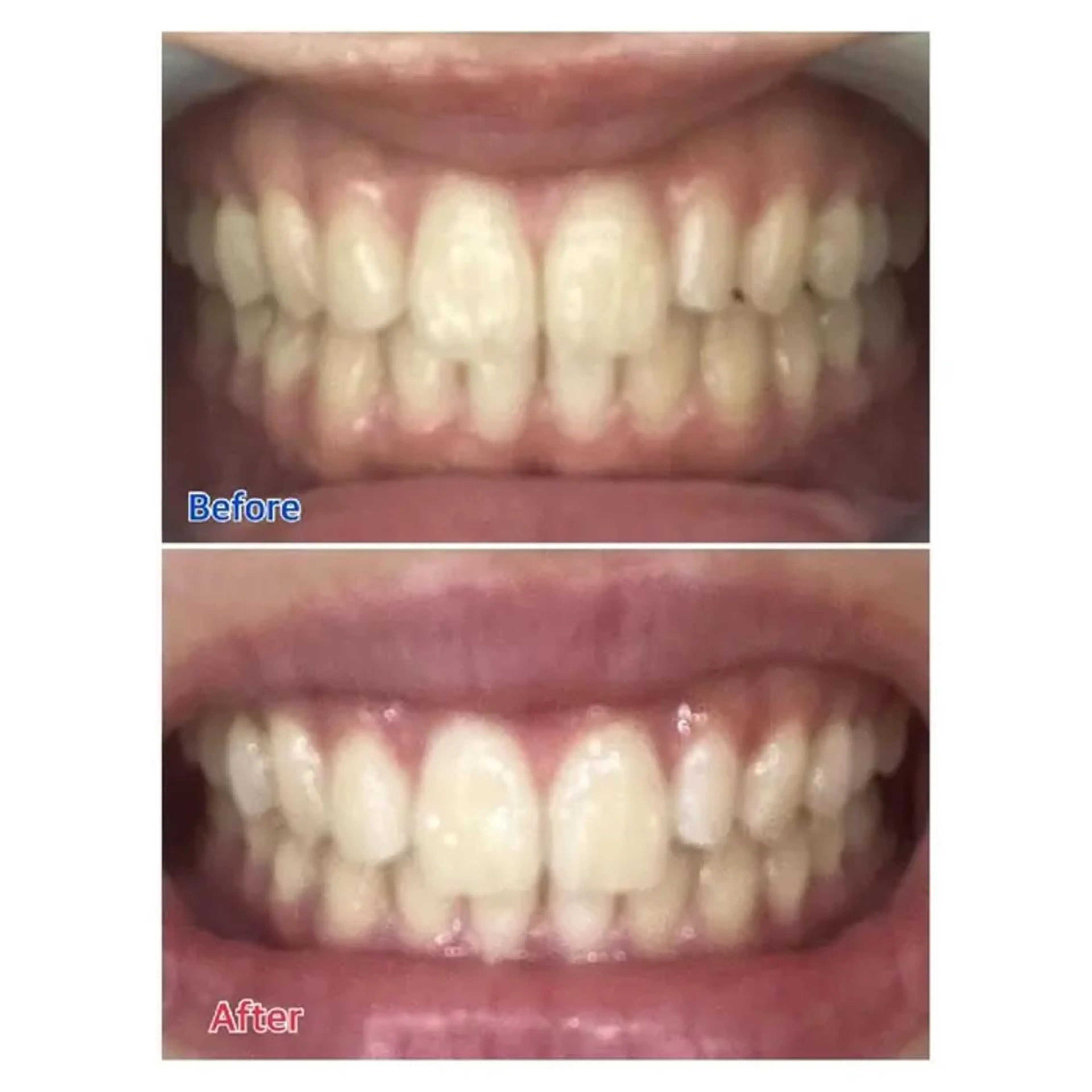 M渋谷店所属・Ｍ渋谷 ホワイトニングのエステ・リラクイメージ