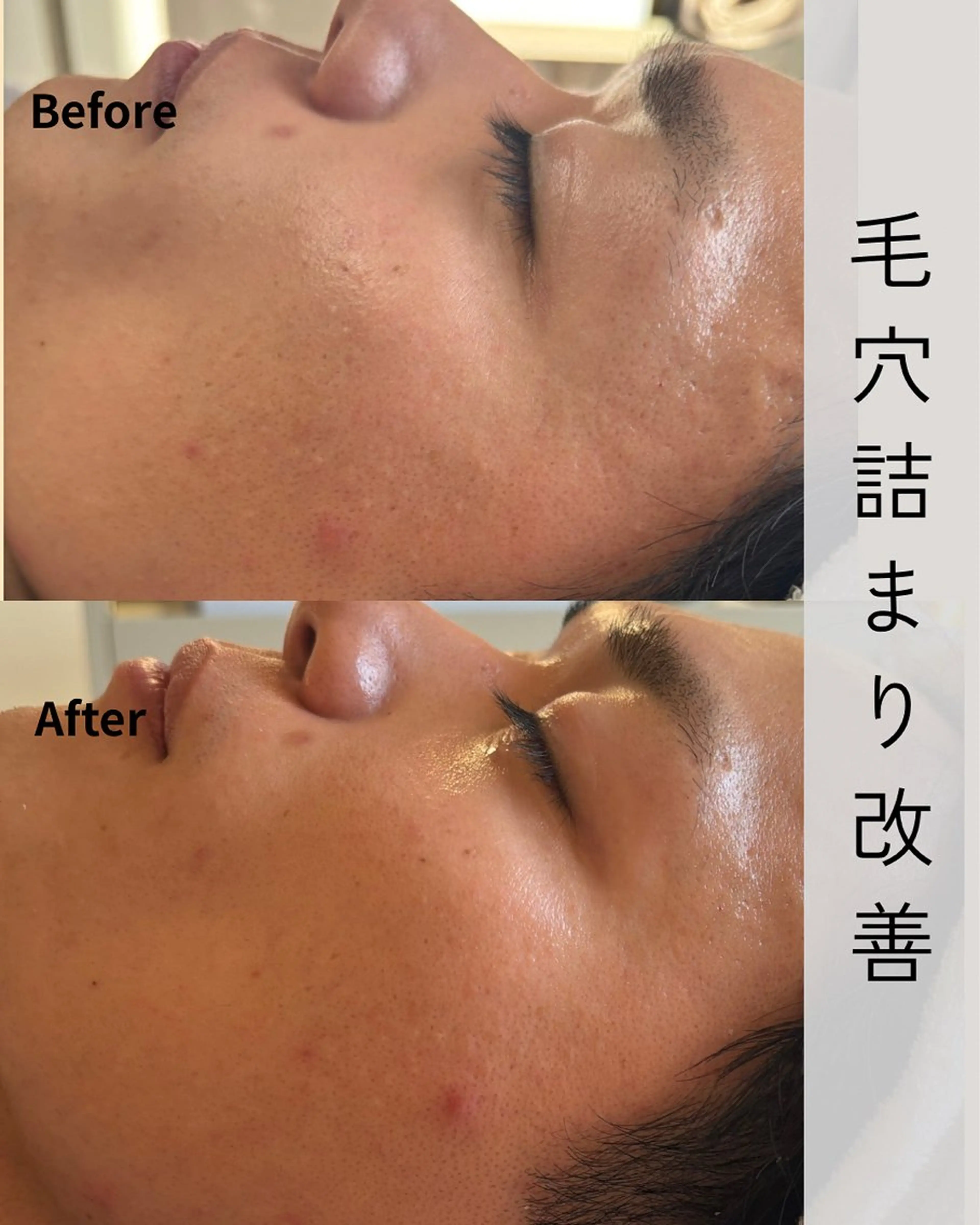 エステ Novelle所属・nozomi.m🌷 narisのエステ・リラクイメージ