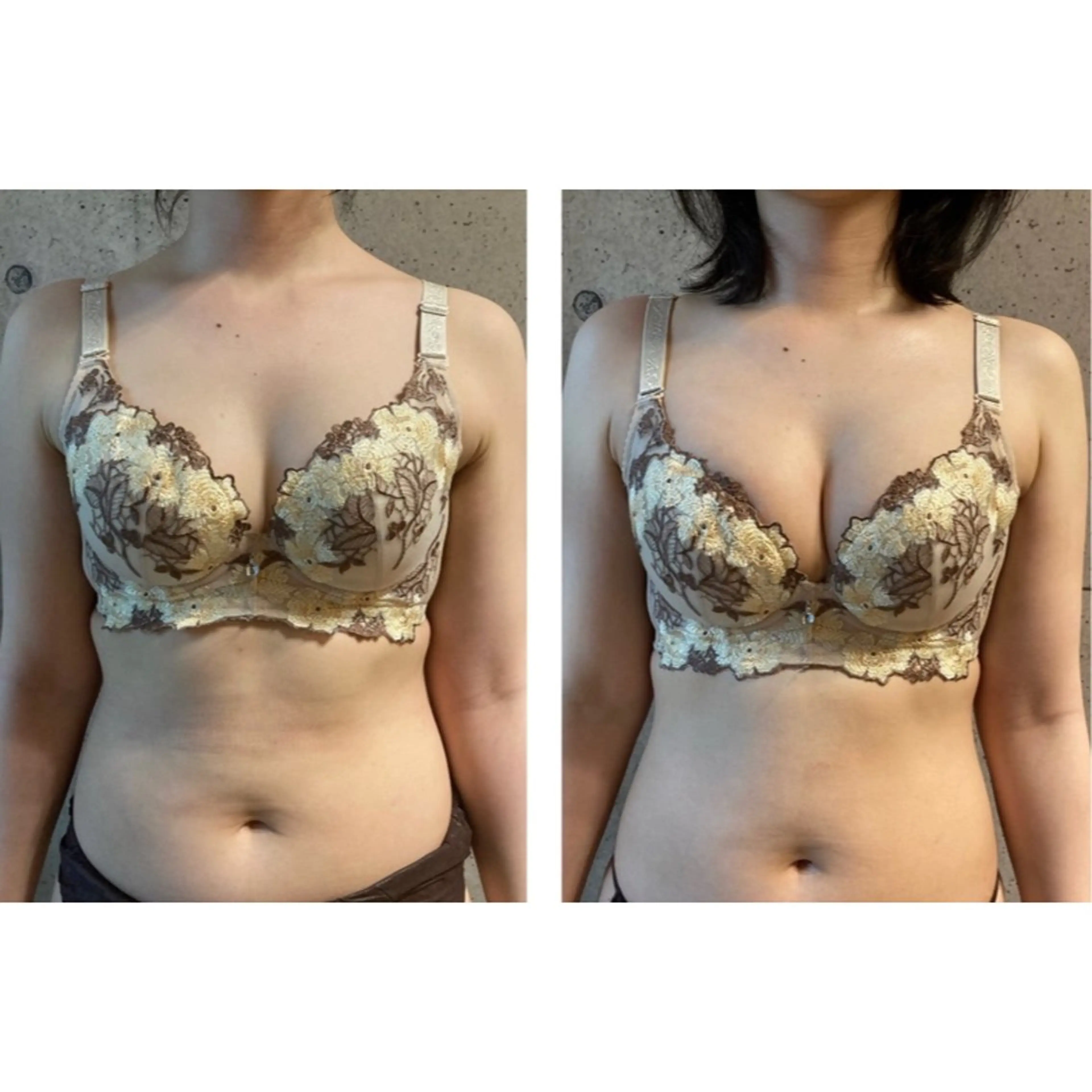 エステ ポテンツァ&針美容 バストアップ専門店のエステ・リラクイメージ