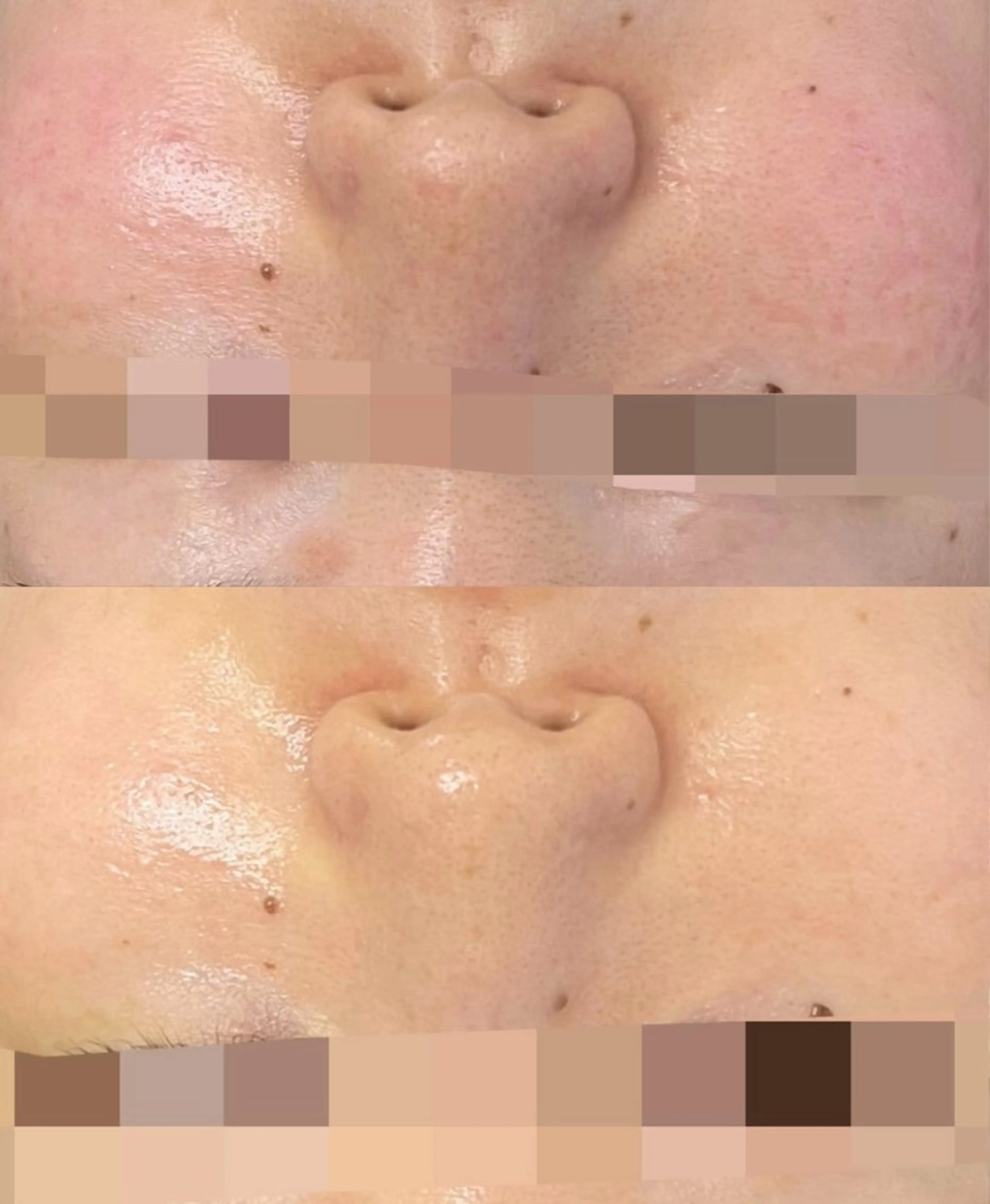 Nsが施術するサロン ナスサロ /Yuriのエステ・リラクイメージ