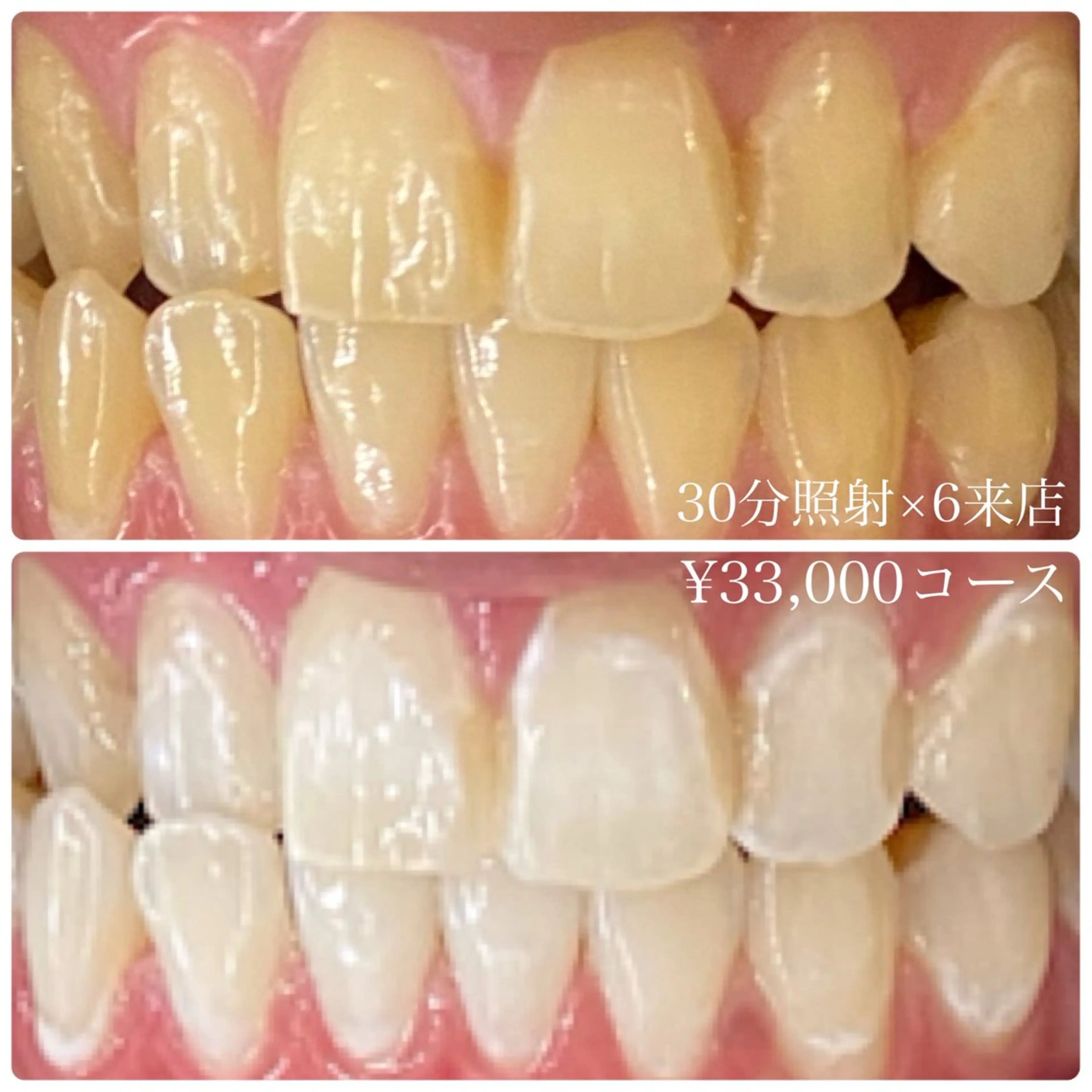 メンズ その他 ホワイトニングルーム 川崎店所属・ホワイトニング ルーム 川崎店のその他イメージ