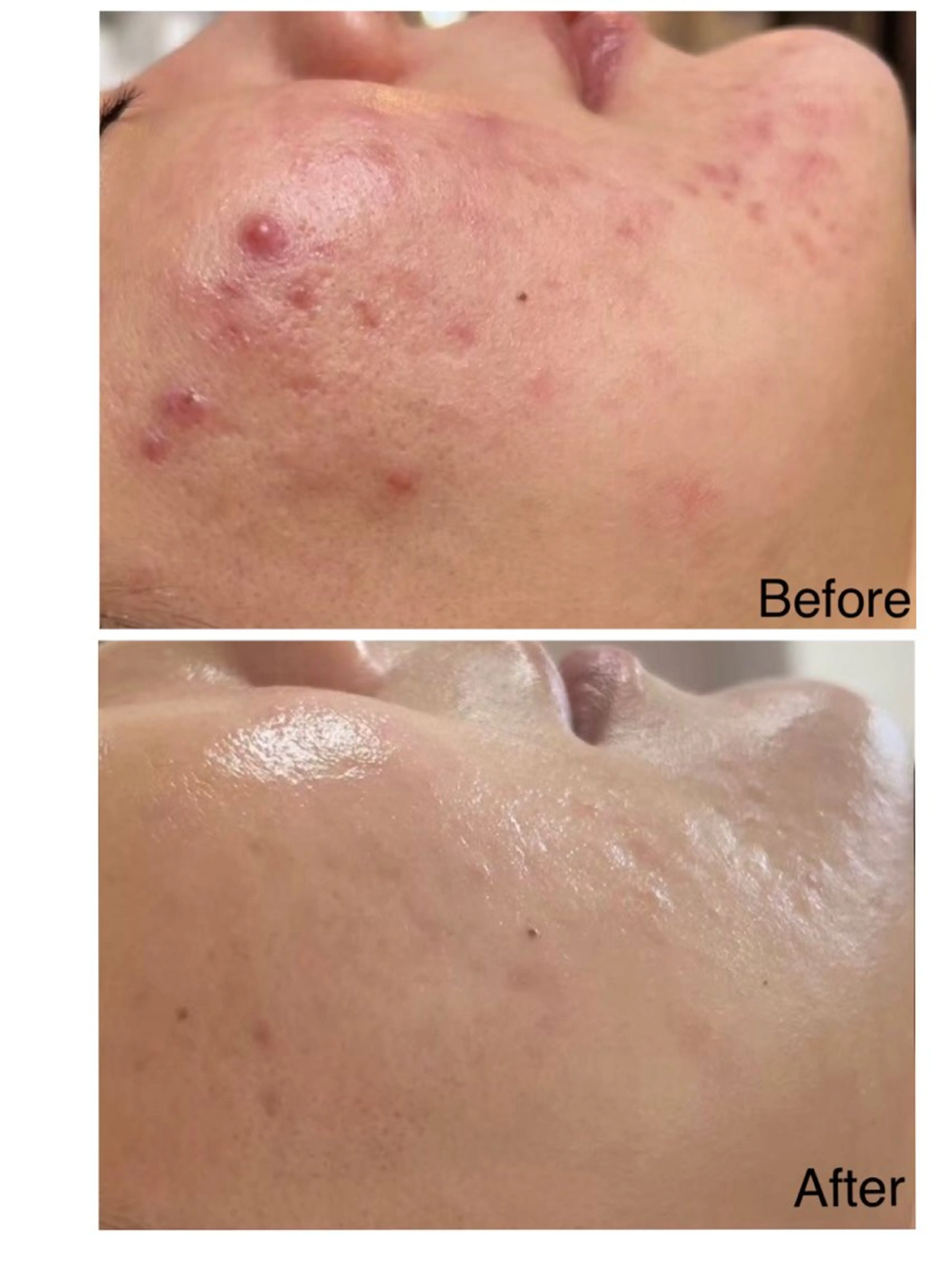 エステ 肌質改善サロン La Divinaのエステ・リラクイメージ