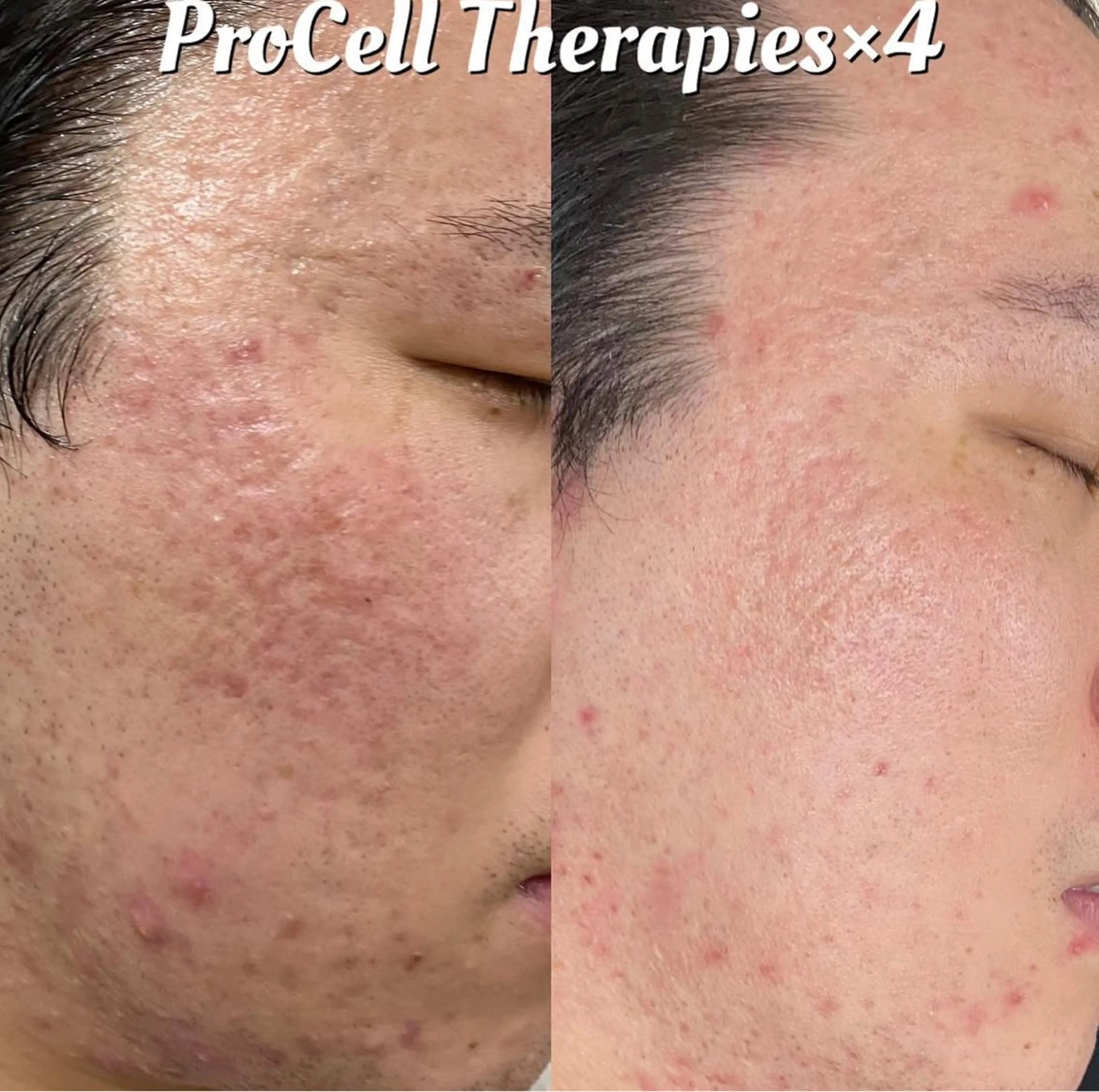 メンズ Blooming所属・LOUISE. ／肌質・頭皮のエステ・リラクイメージ