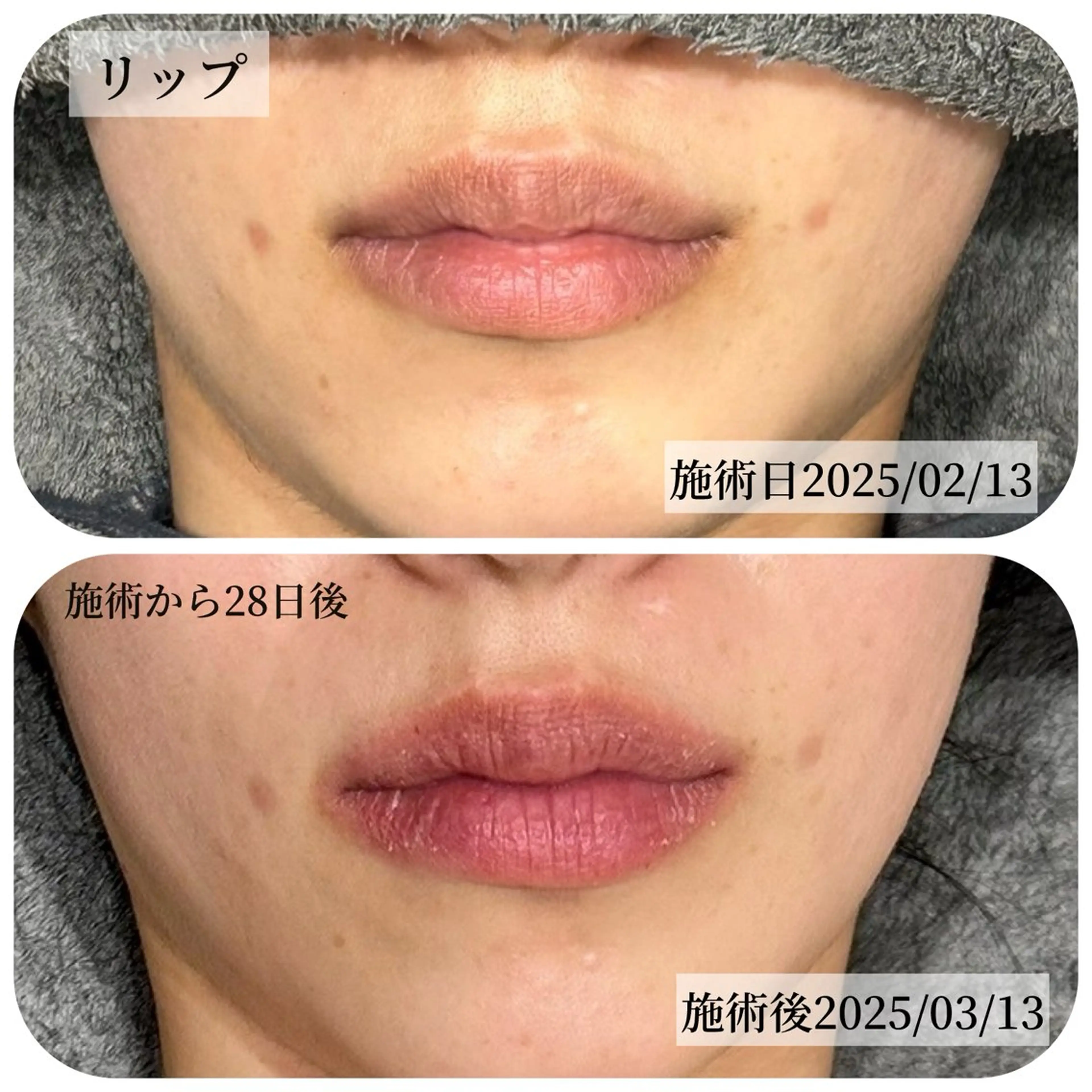 その他 Salon ALLIUM 恵比寿のエステ・リラクイメージ