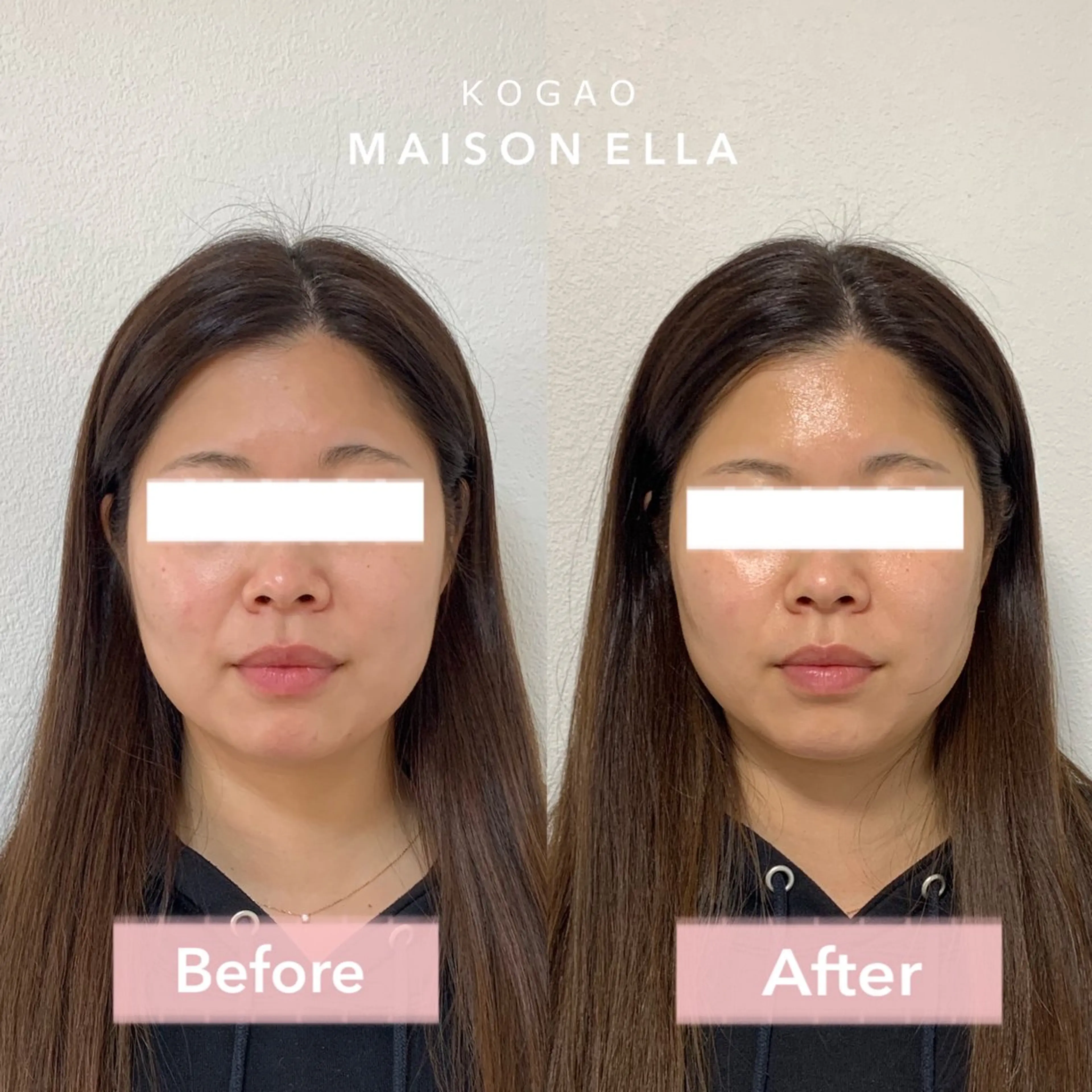 小顔　MAISON ELLAのエステ・リラクイメージ