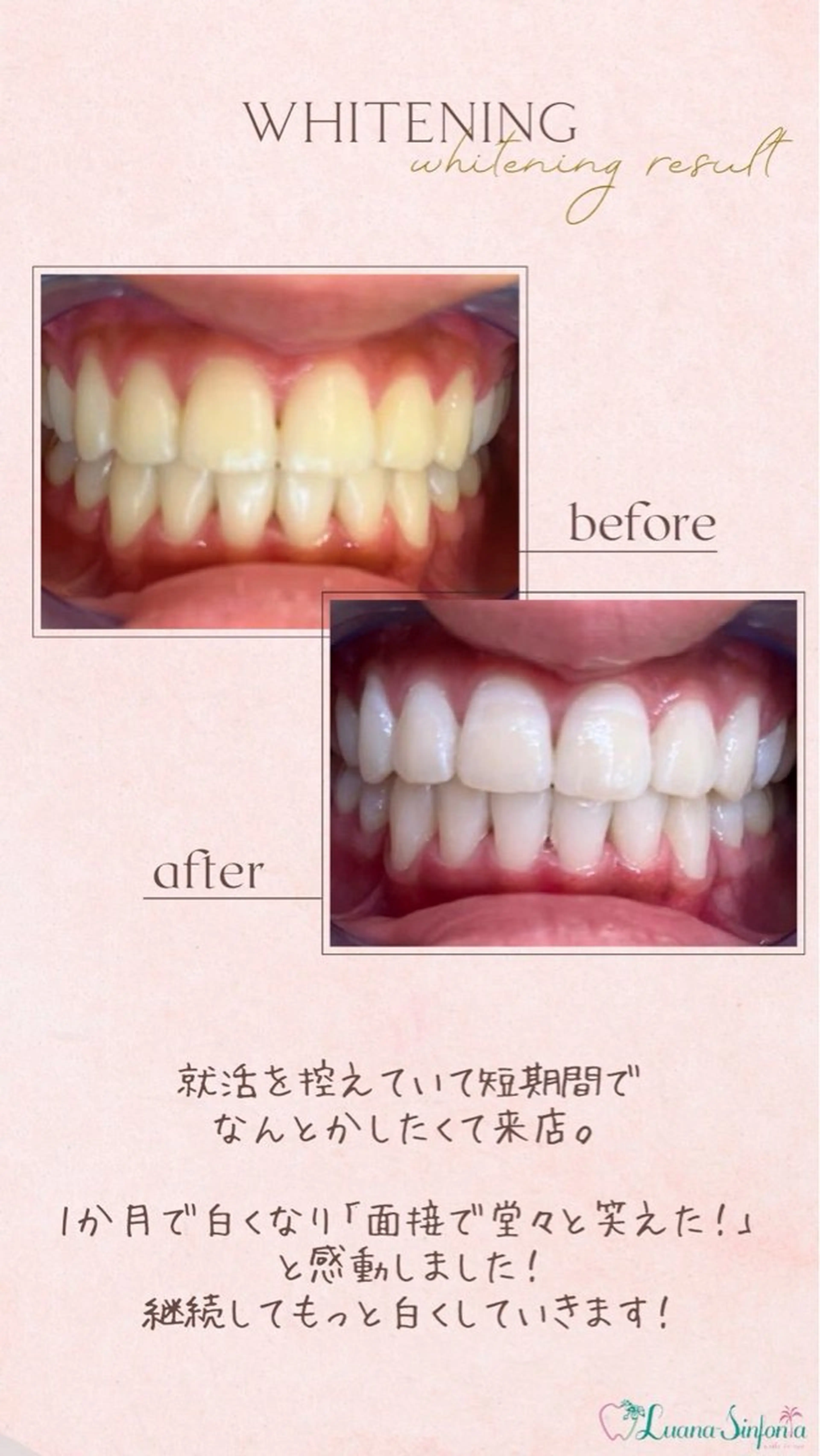 ホワイトニングサロンLuana-Sinfonia(エクシア)池袋店所属・セルフホワイトニング エクシア 池袋店のその他イメージ