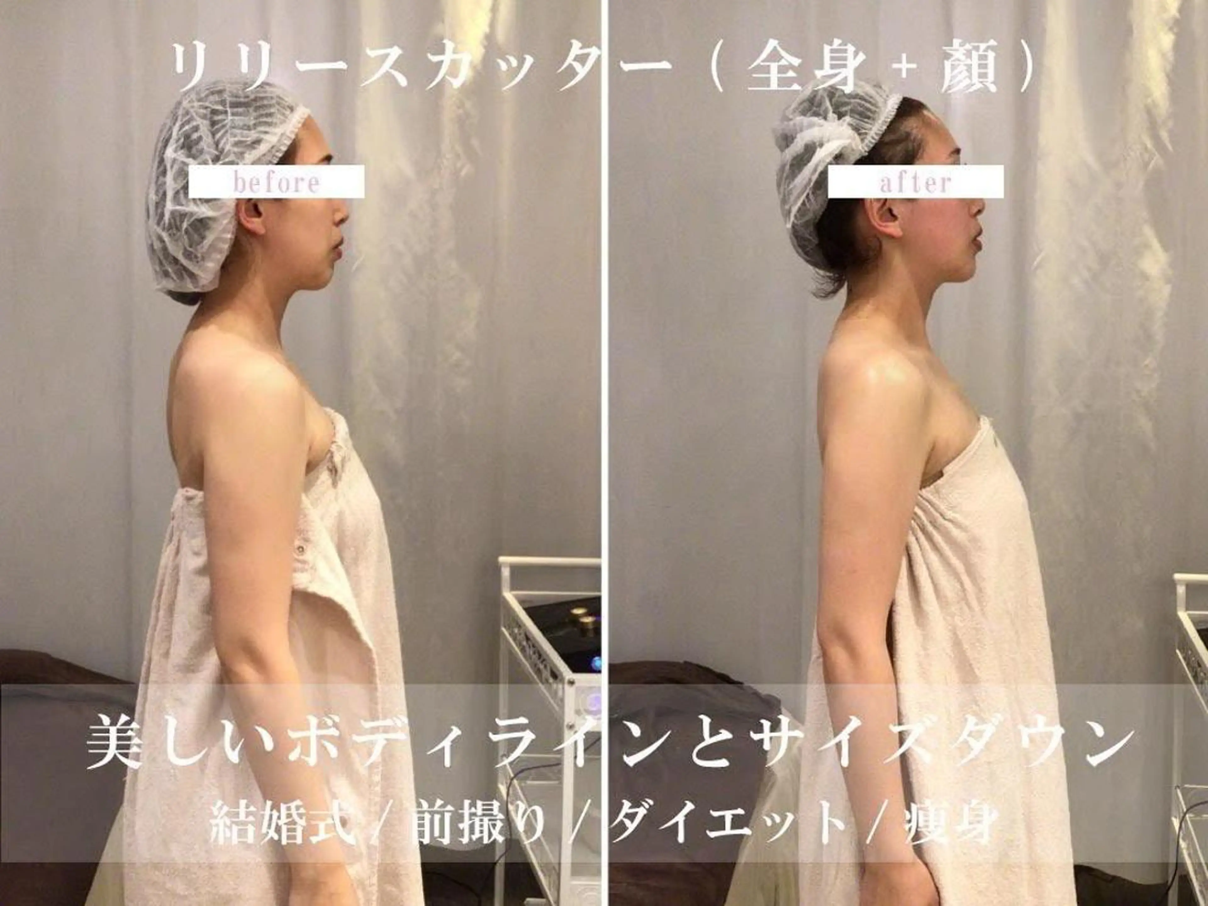 【全身+顔】満足No1★速攻！浮腫みすっきりダイエット◎リリースカッター100分の写真