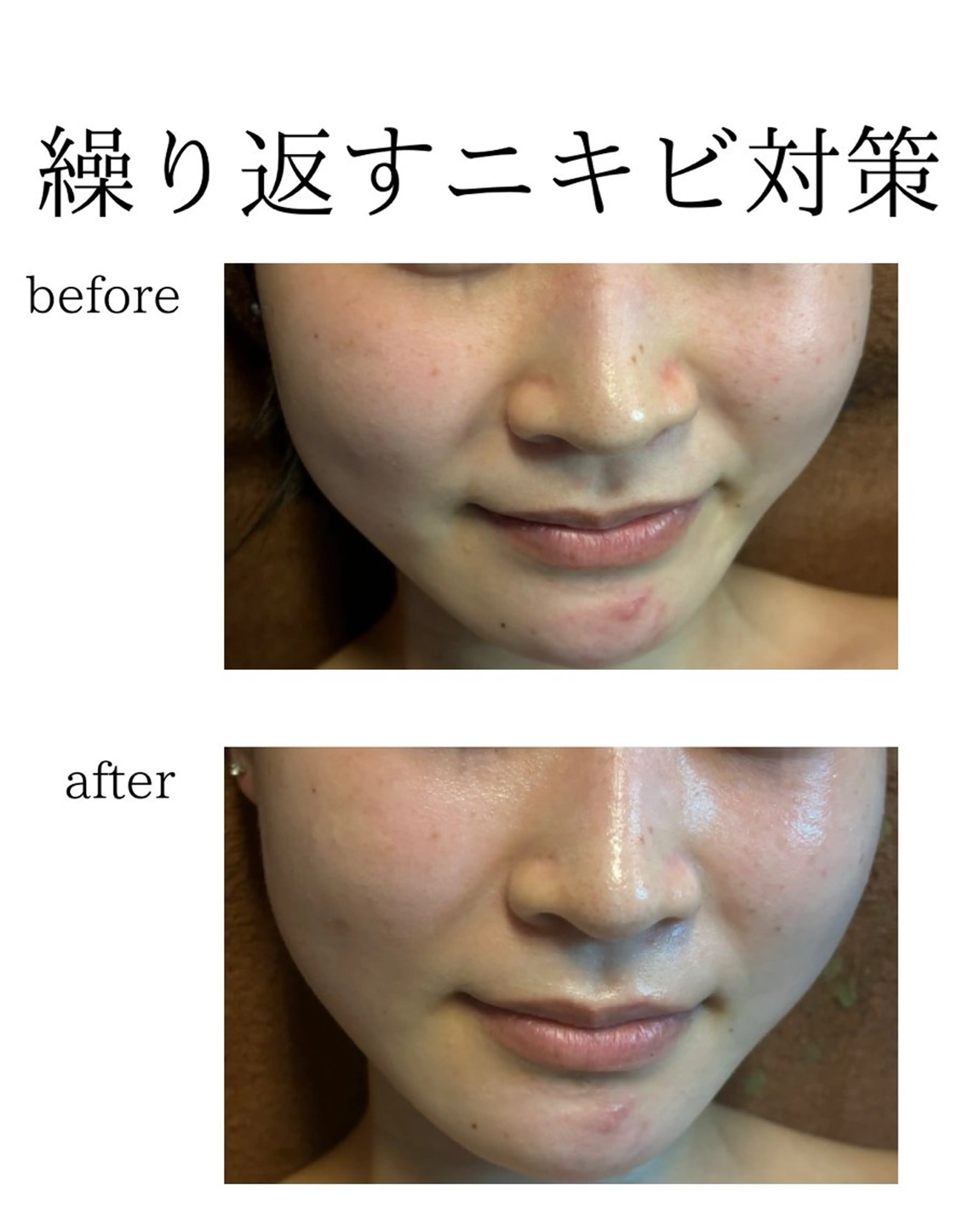 Salon【yuzu.】所属・🍊肌管理×美眉 【yuzu.】の眉毛・アイブロウイメージ