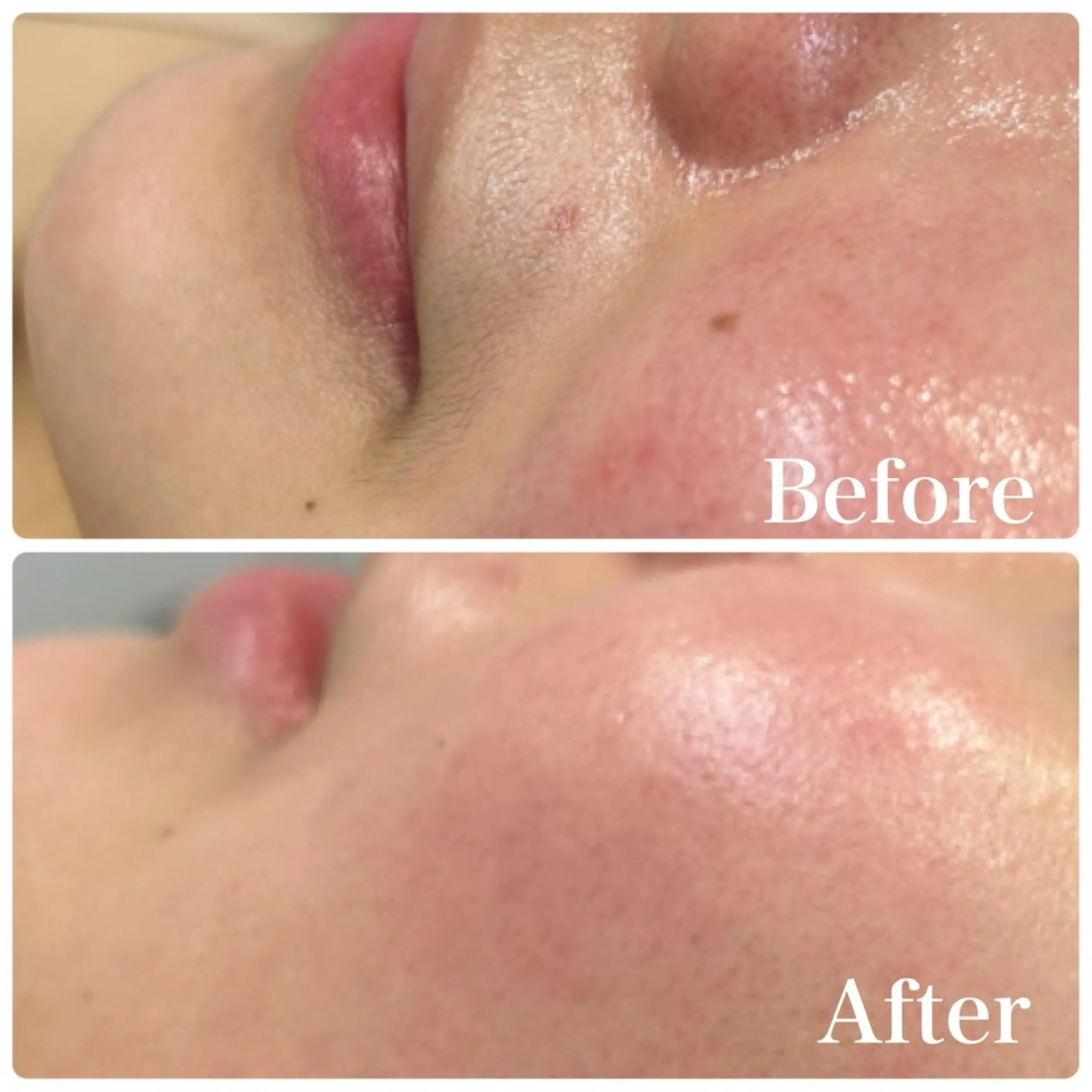 エステ LAKI eye&face studio所属・laki studioの眉毛・アイブロウイメージ