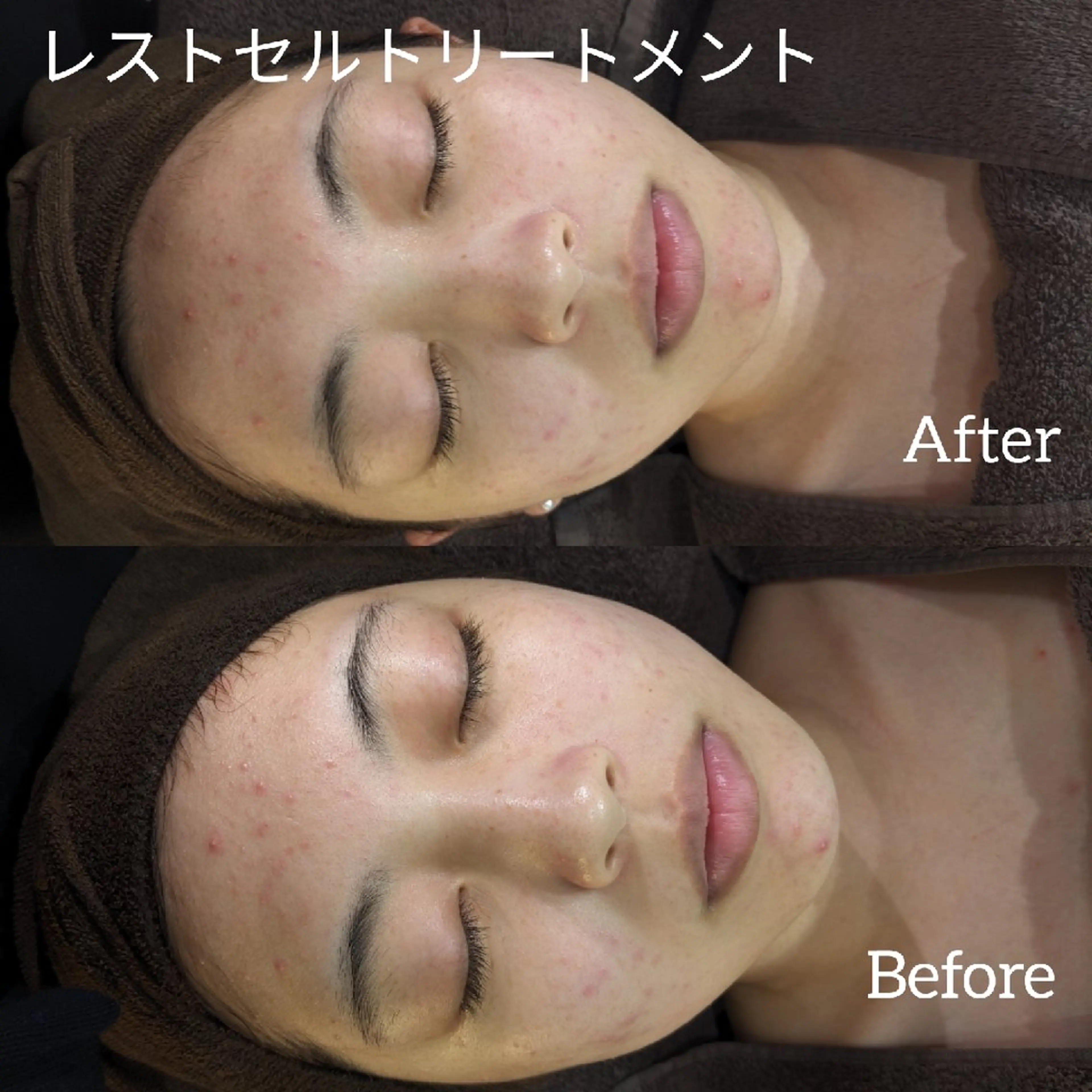 エステ フェイシャルエステ ラトゥール伊深のエステ・リラクイメージ