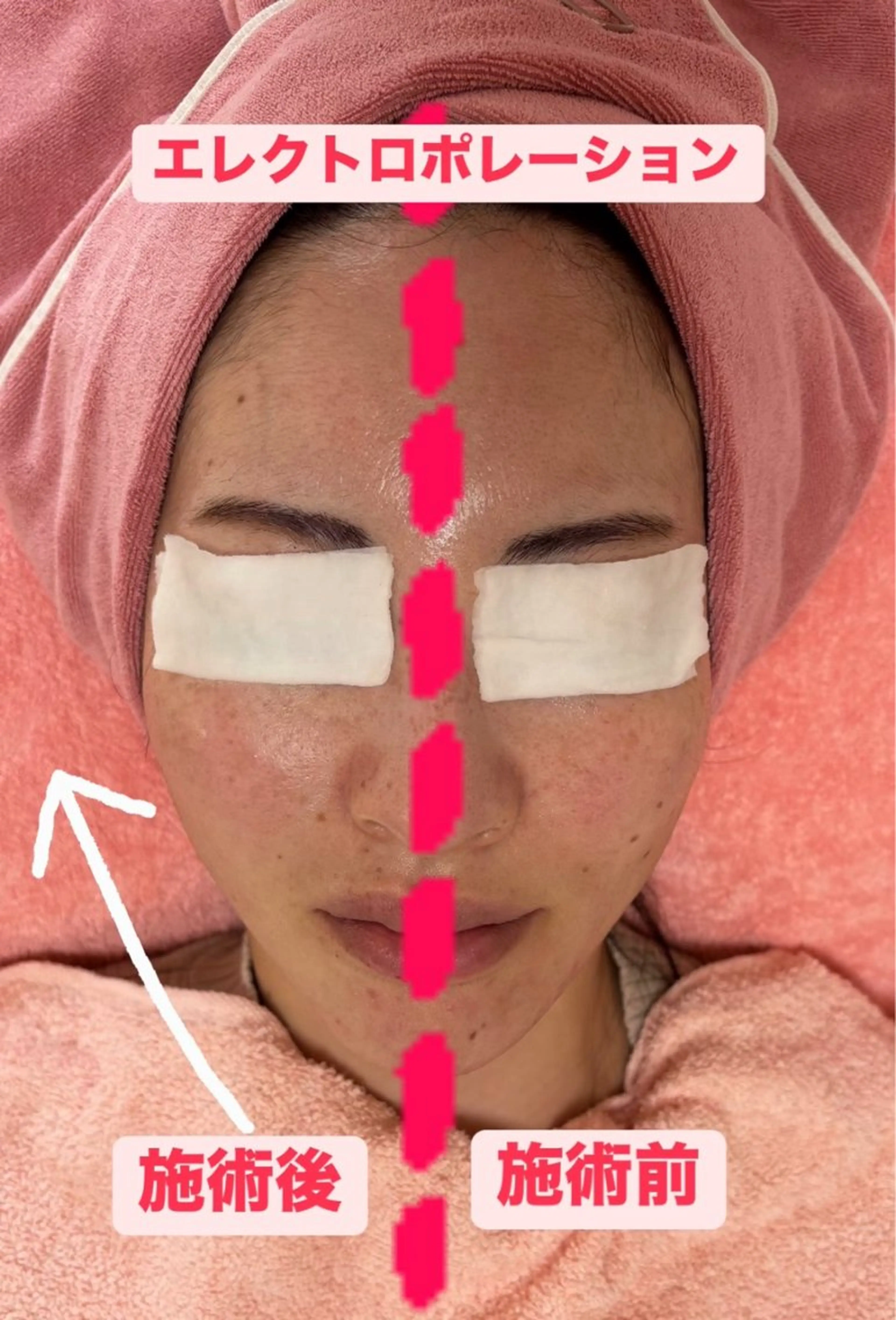 エステ akua... 【肌質管理専門】のその他イメージ