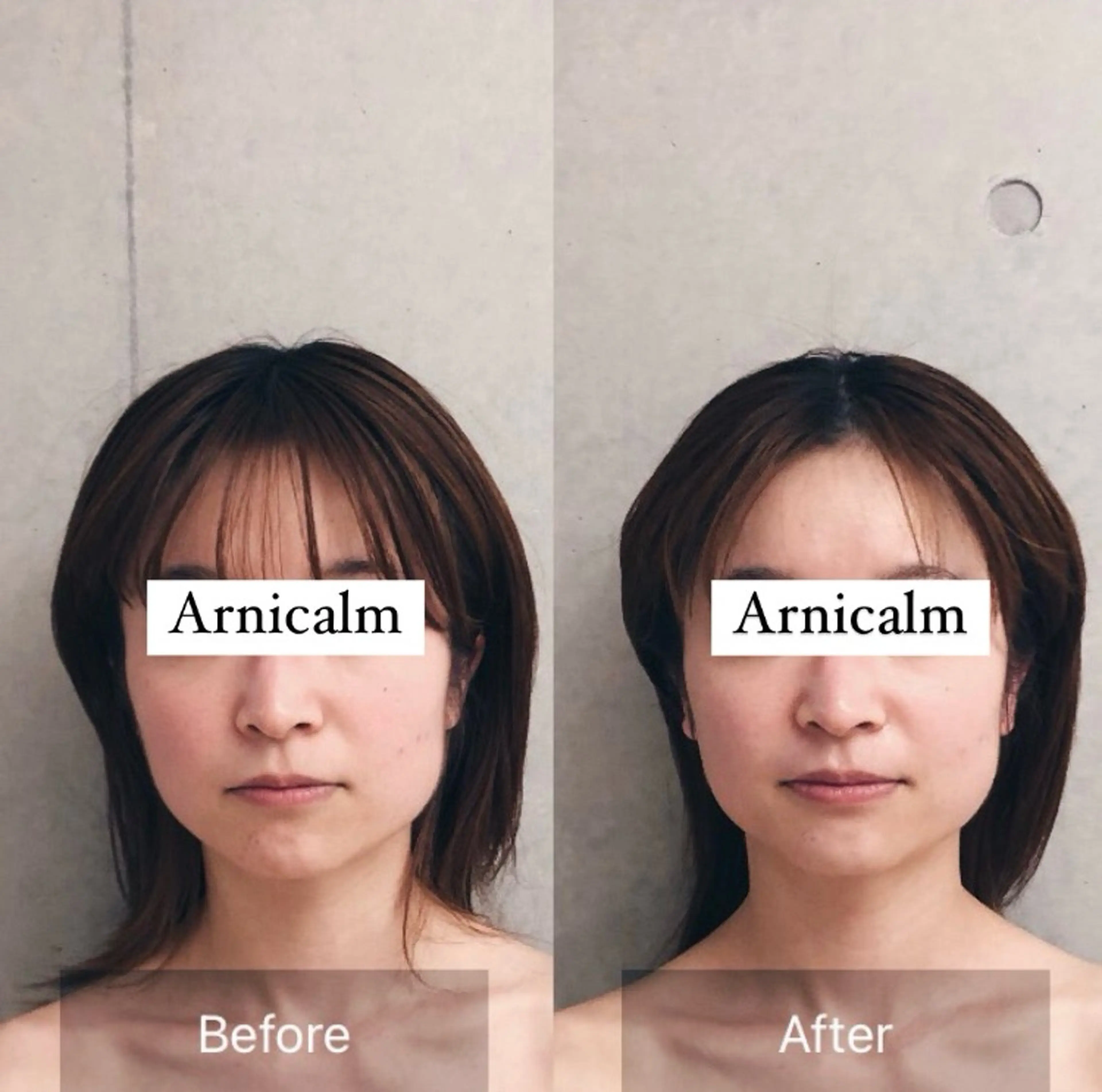 エステ ハーブピーリング 肌再生ピーリング/のエステ・リラクイメージ