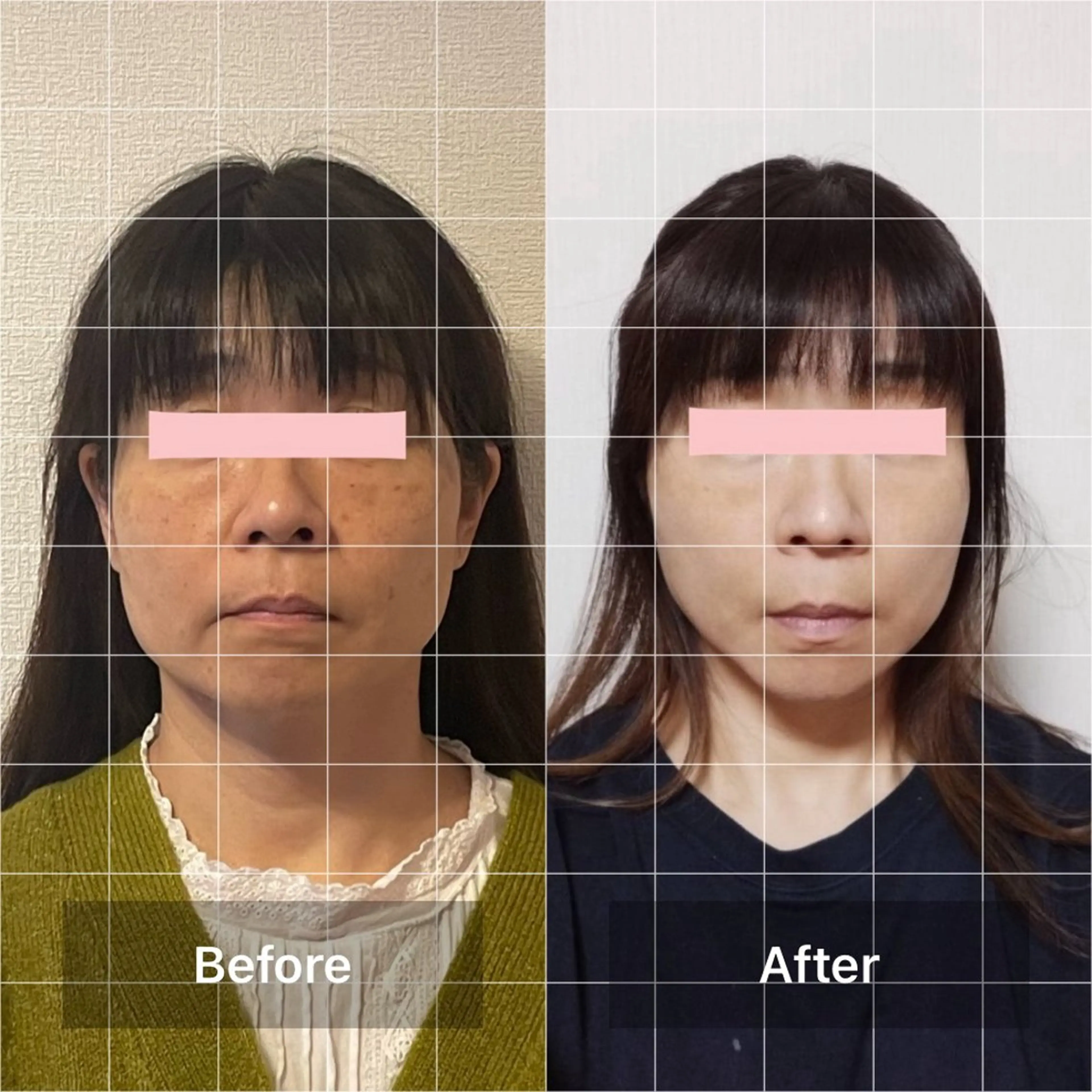 エステ 小顔矯正＆ロミロミ ラハイナ所属・小顔矯正 ラハイナのエステ・リラクイメージ