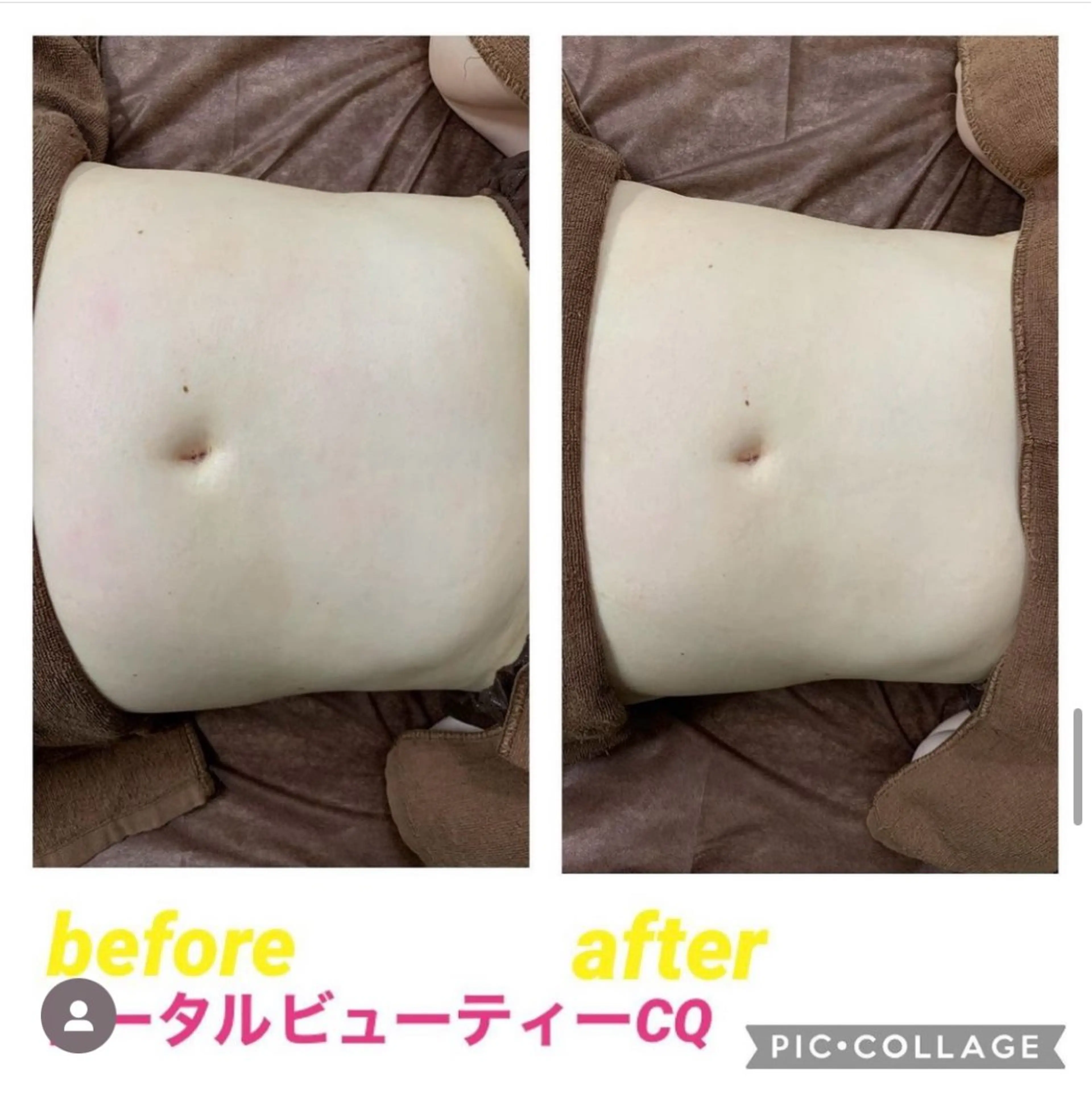 トータルビューティー CQのネイルデザイン